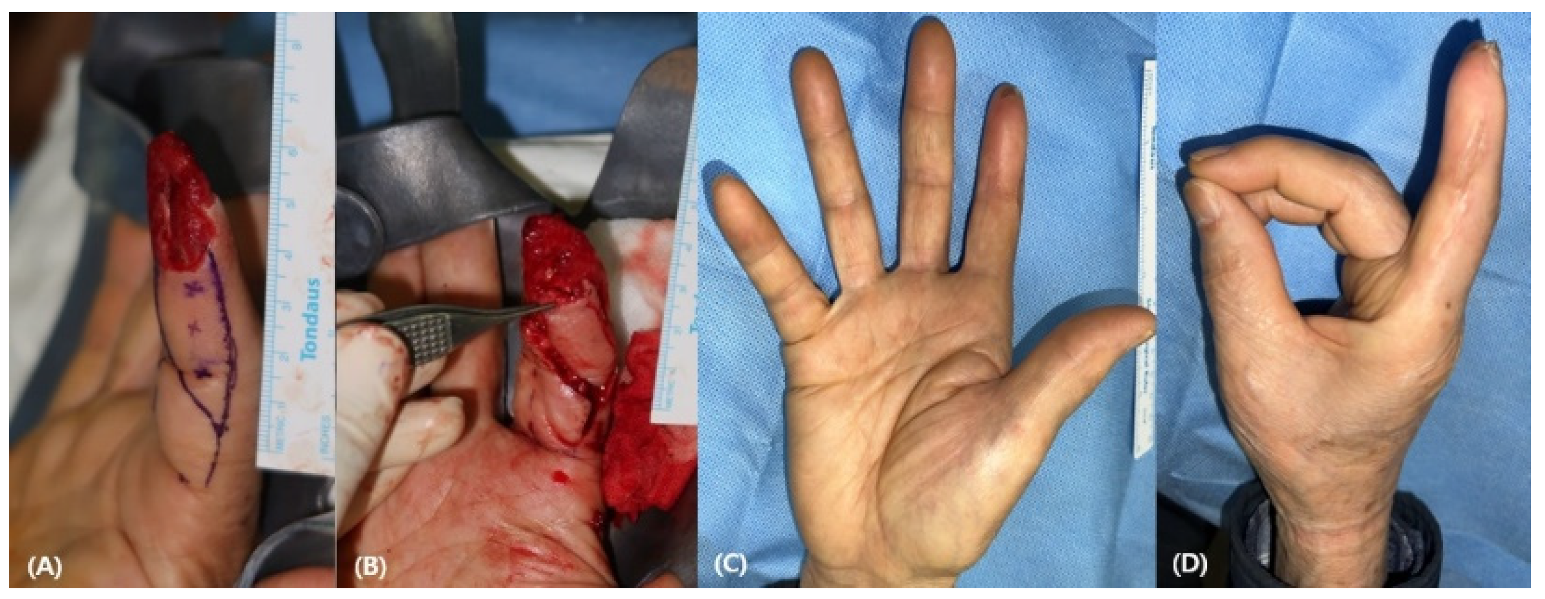 Medicina 58 01483 g005