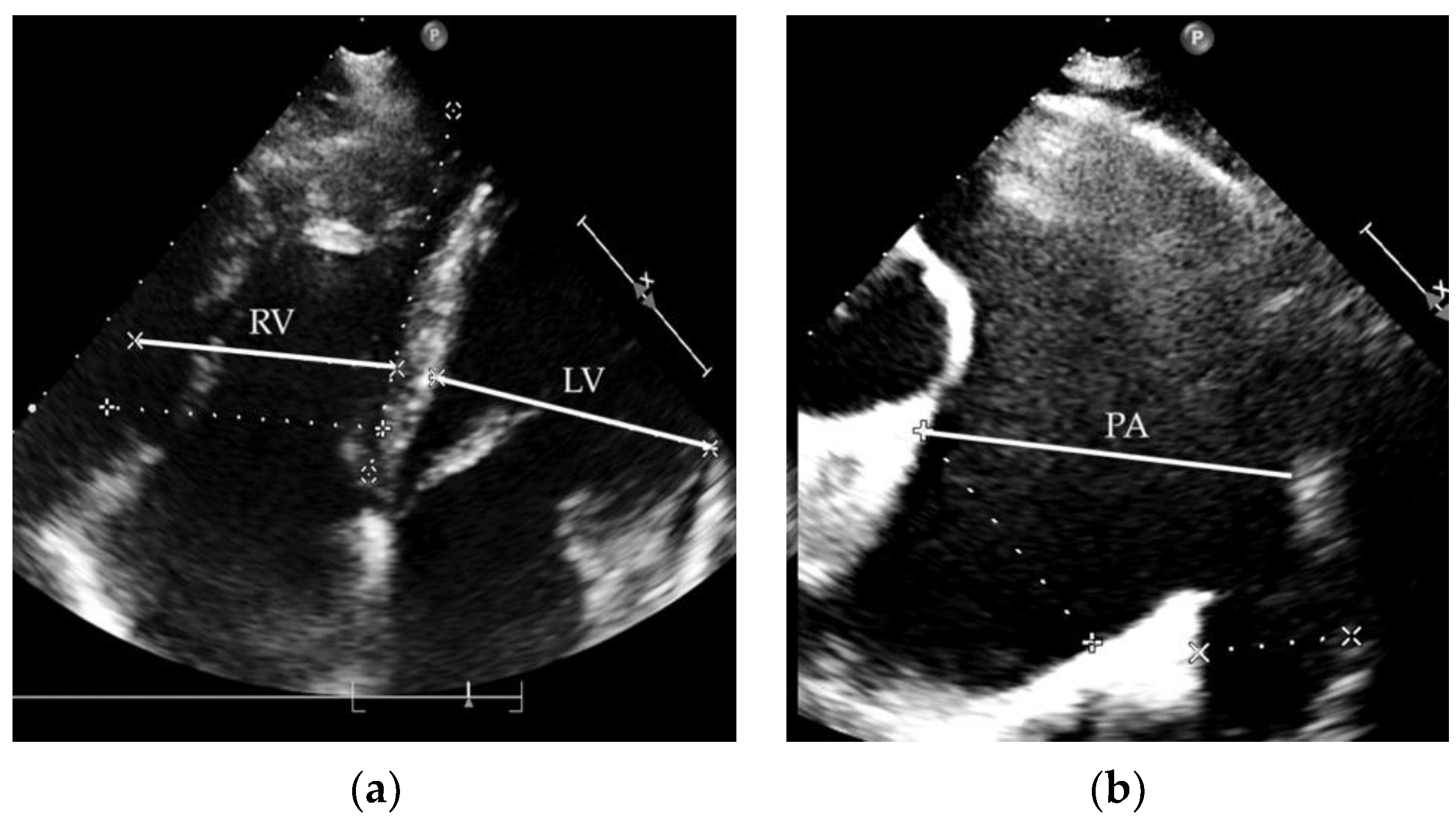 Medicina 58 01484 g002