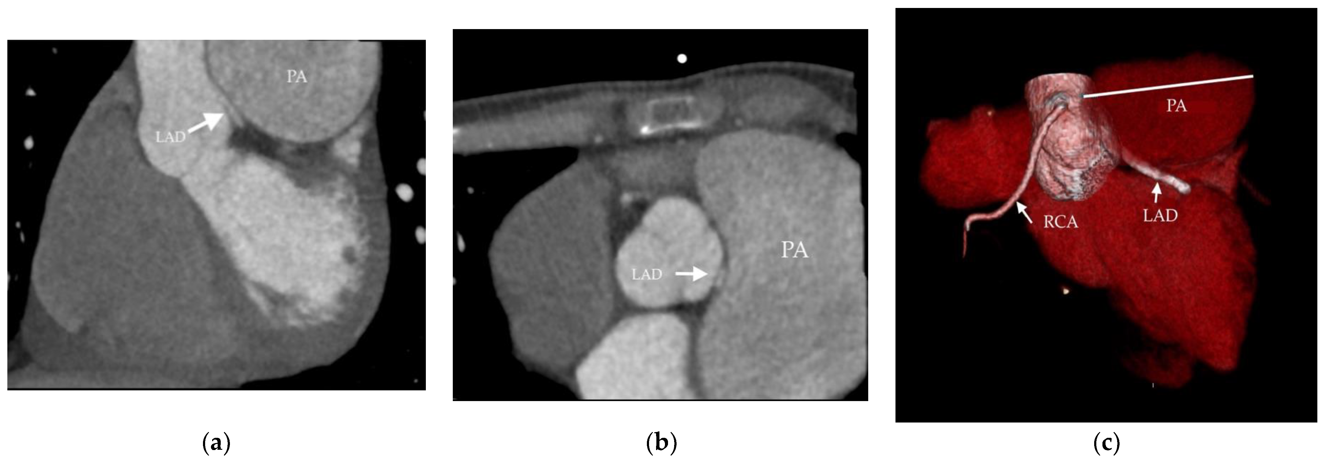 Medicina 58 01484 g003