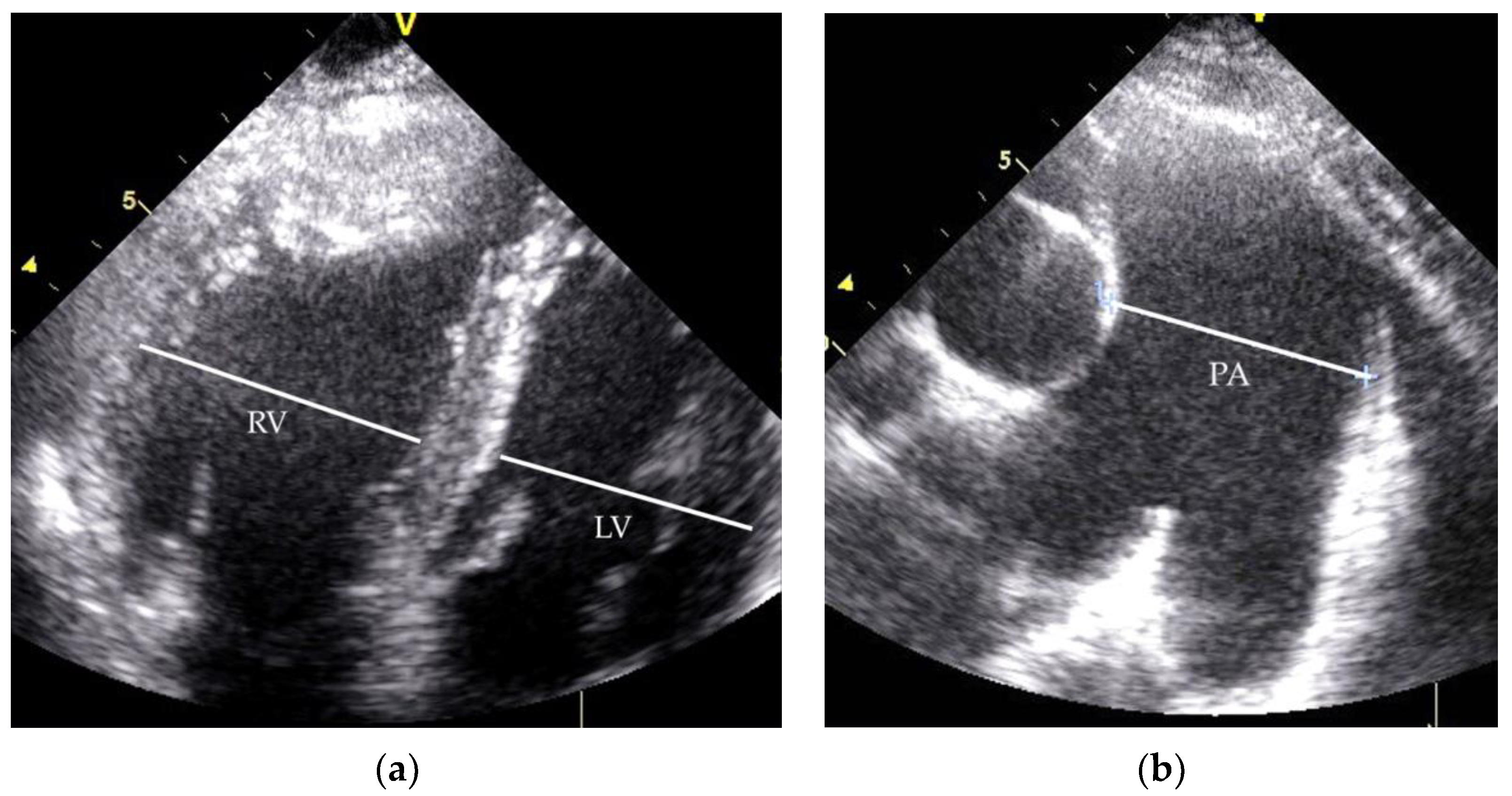 Medicina 58 01484 g005