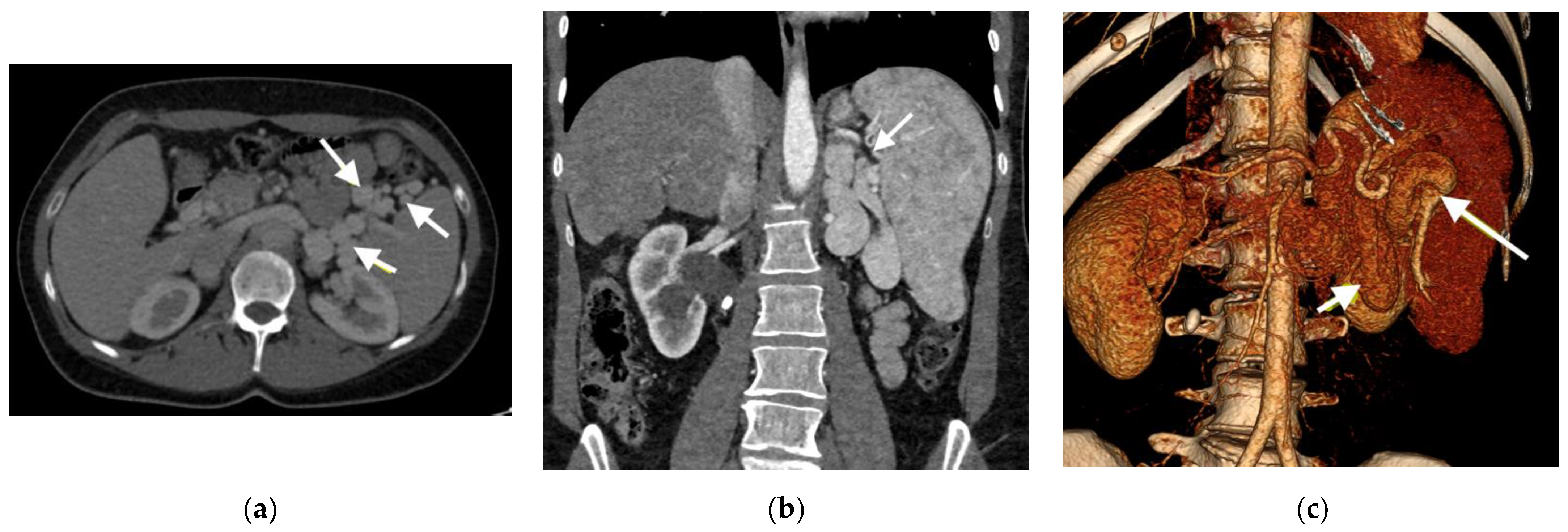 Medicina 58 01484 g006