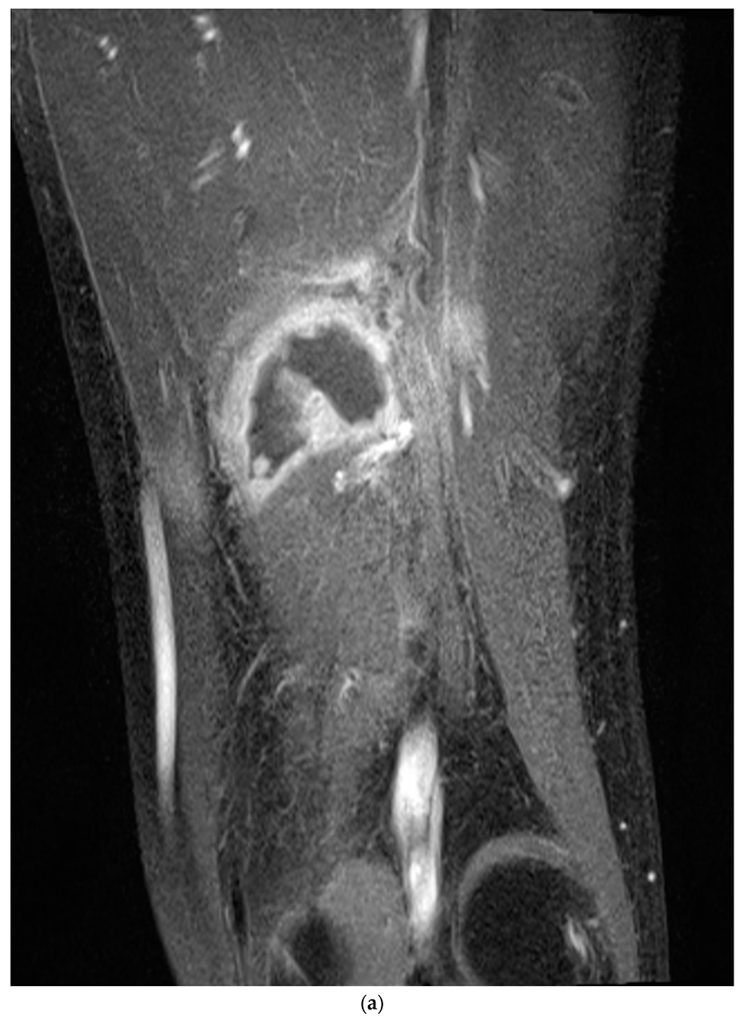 Medicina 58 01497 g003a 550