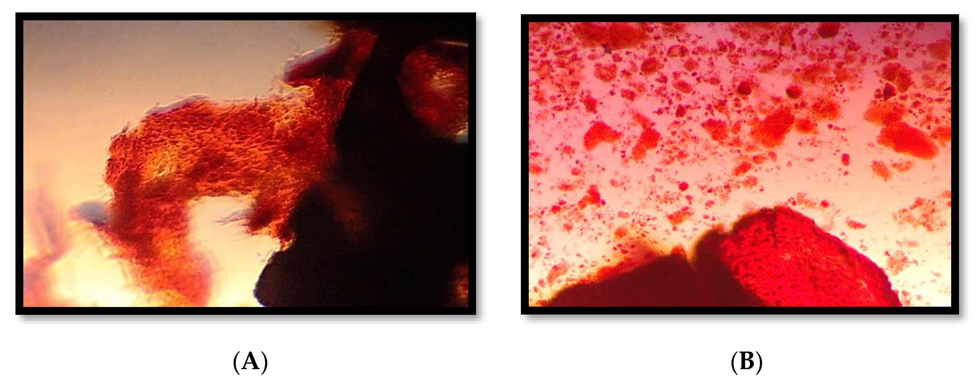 Medicina 58 01518 g002