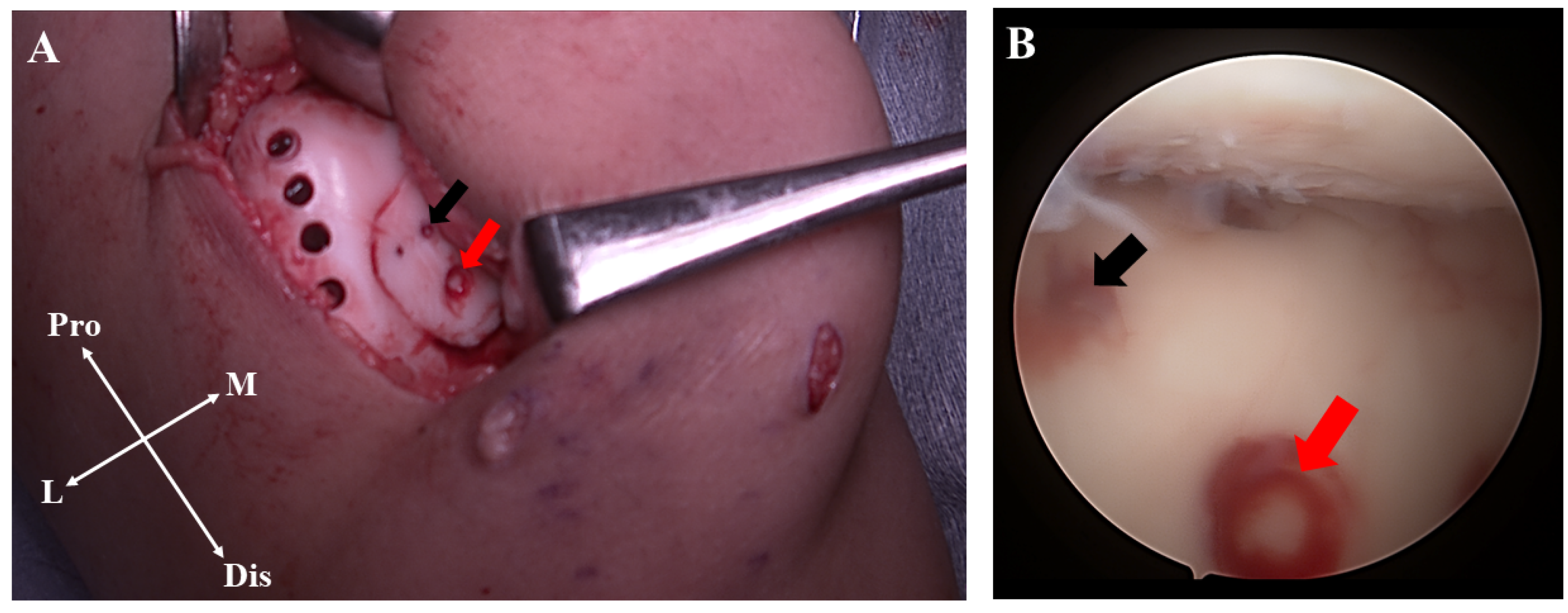Medicina 58 01528 g005