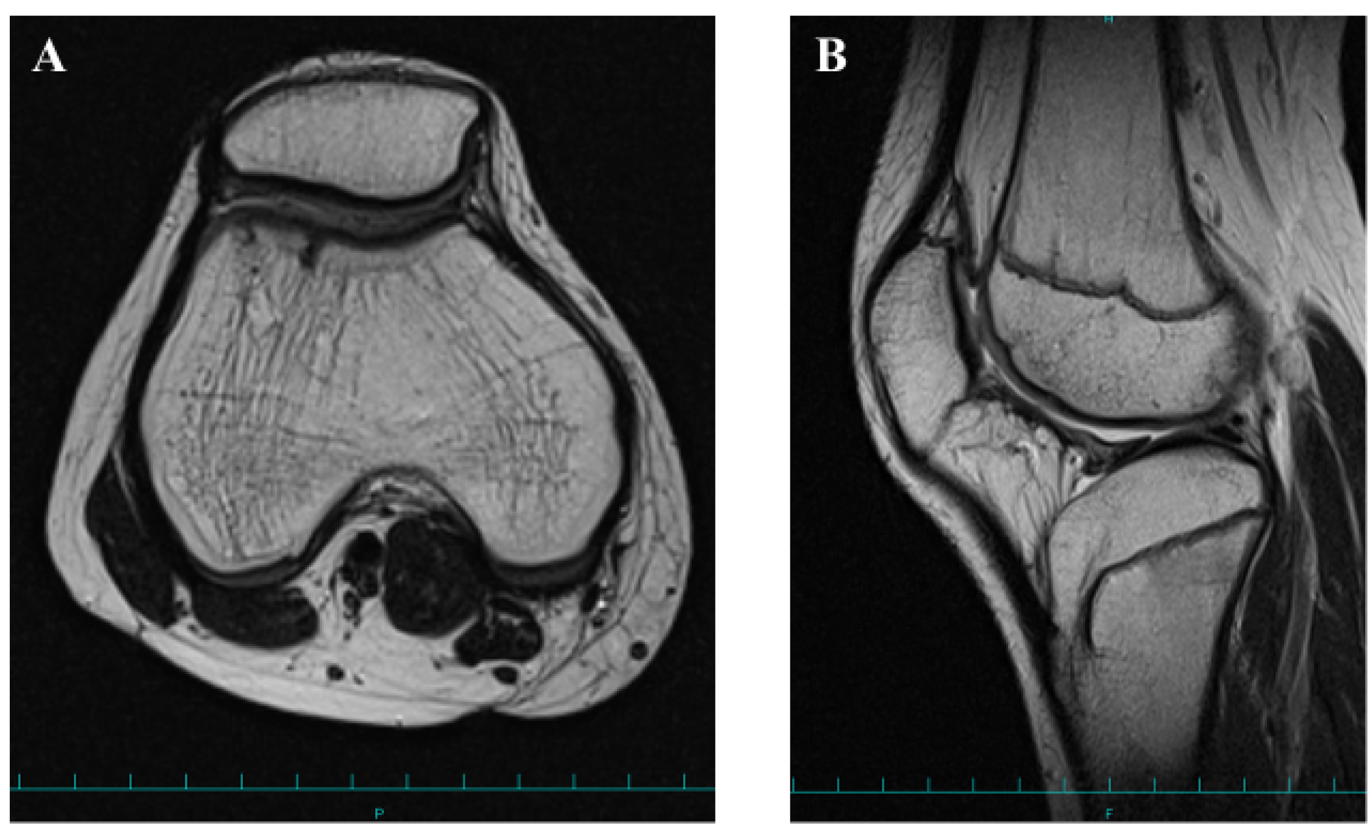 Medicina 58 01528 g006