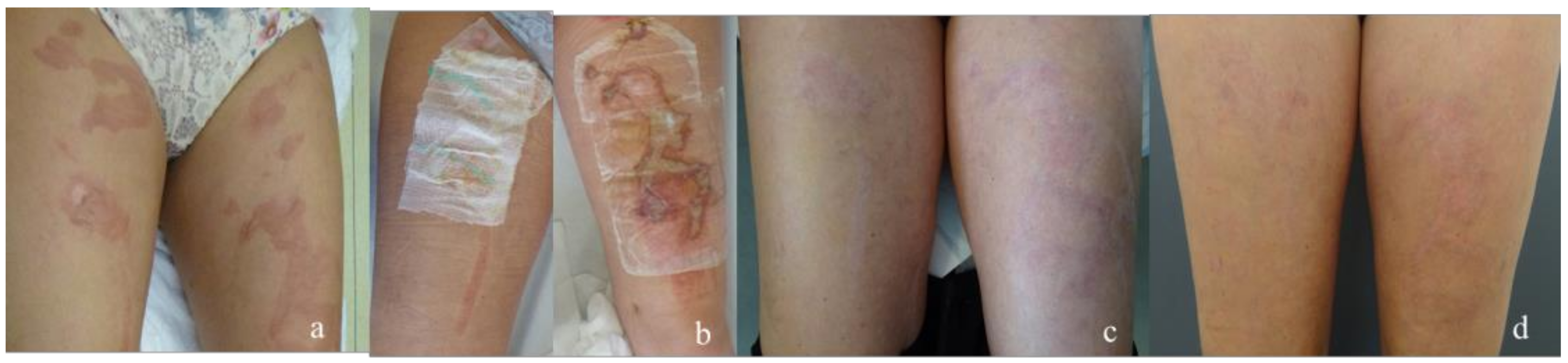 Medicina 58 01550 g001 Medicina 58 01550 g001