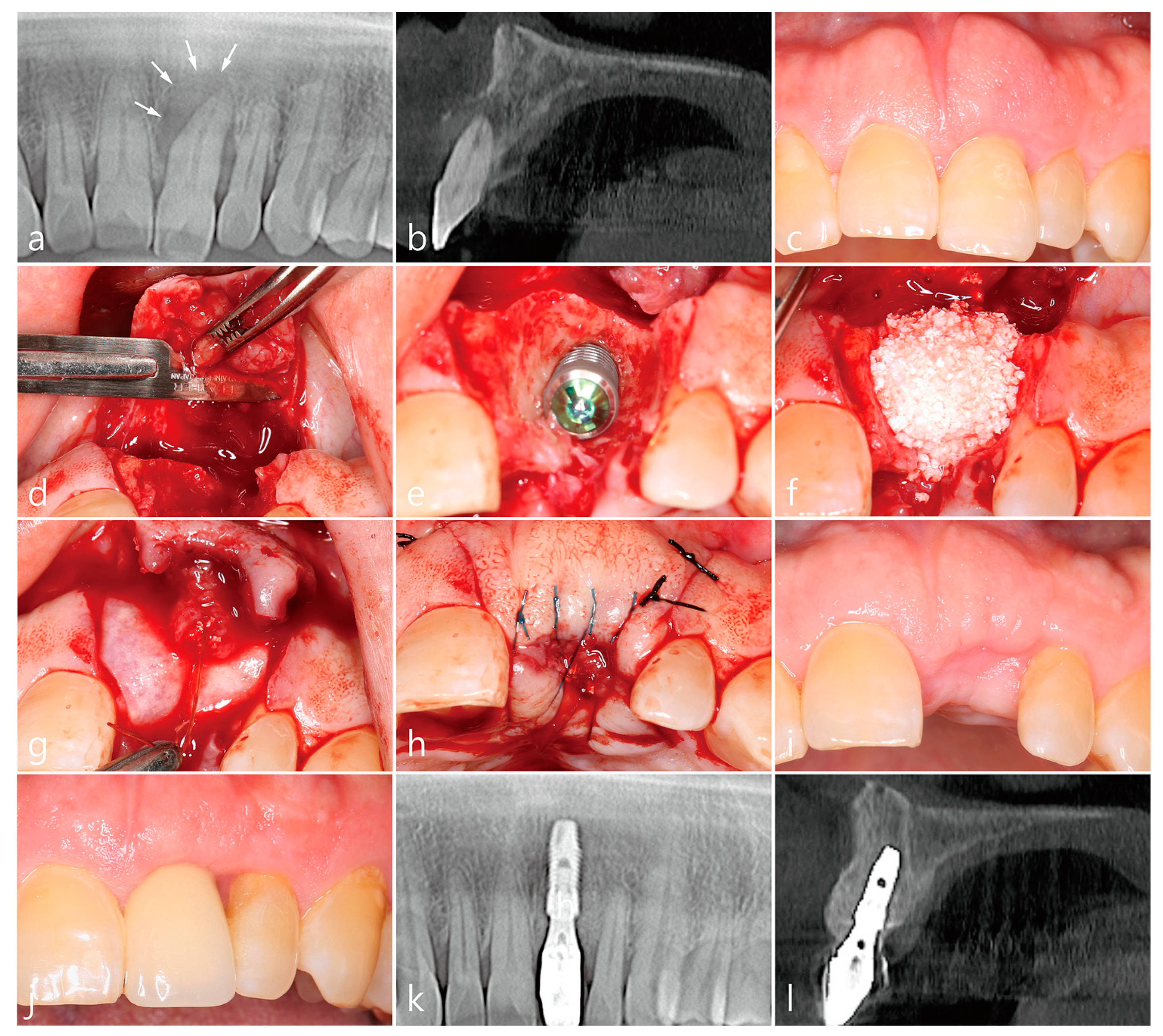 Medicina 58 01555 g001