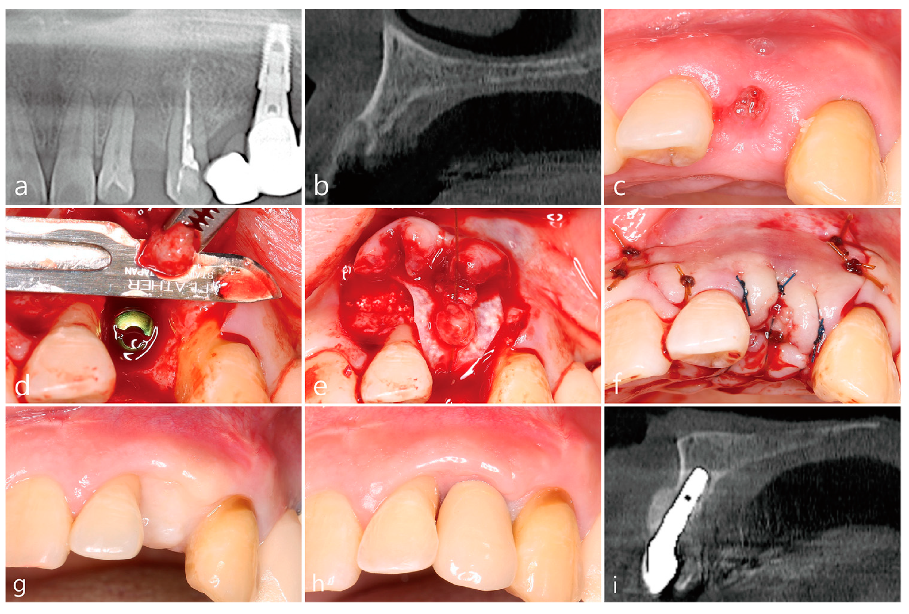 Medicina 58 01555 g002