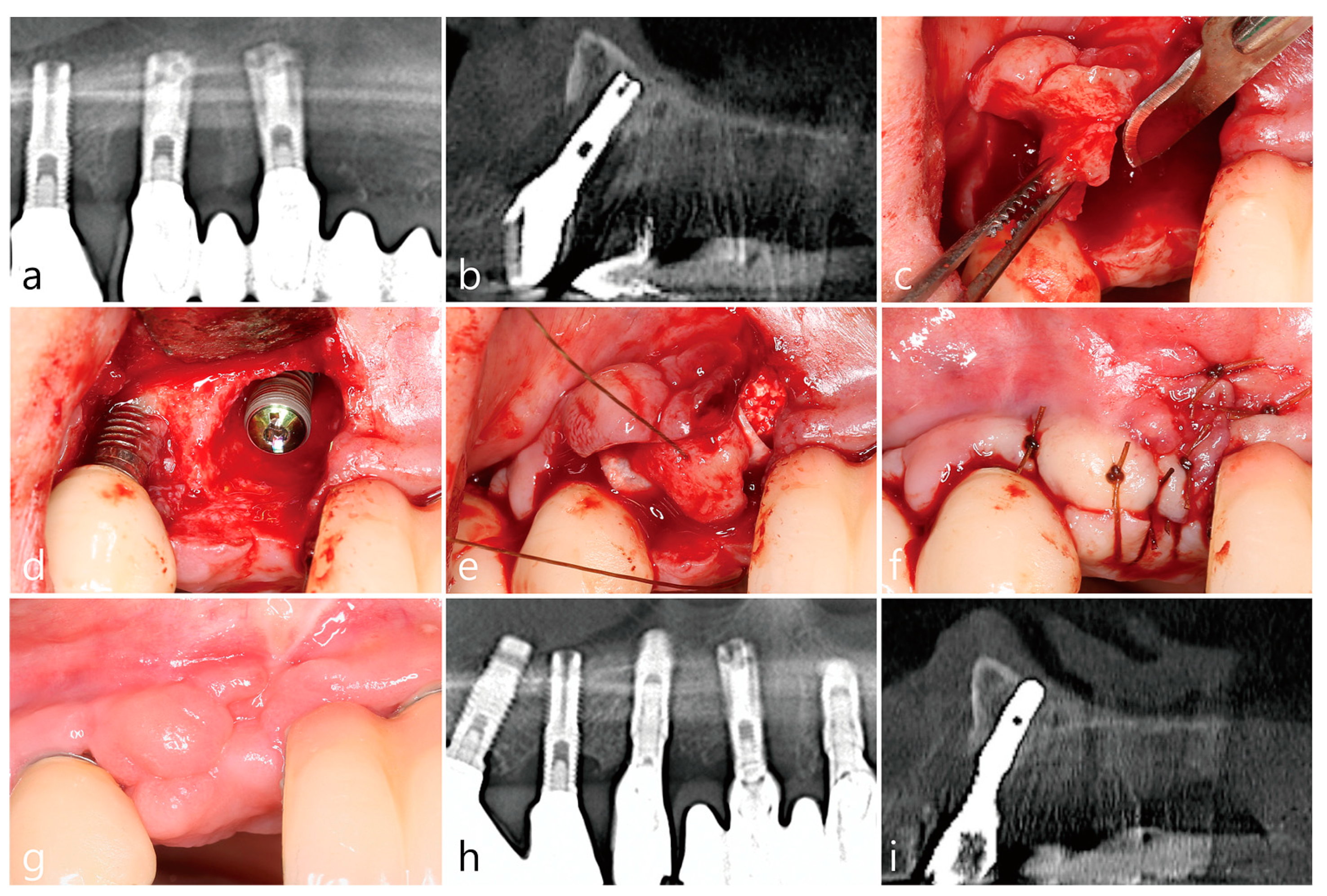 Medicina 58 01555 g004