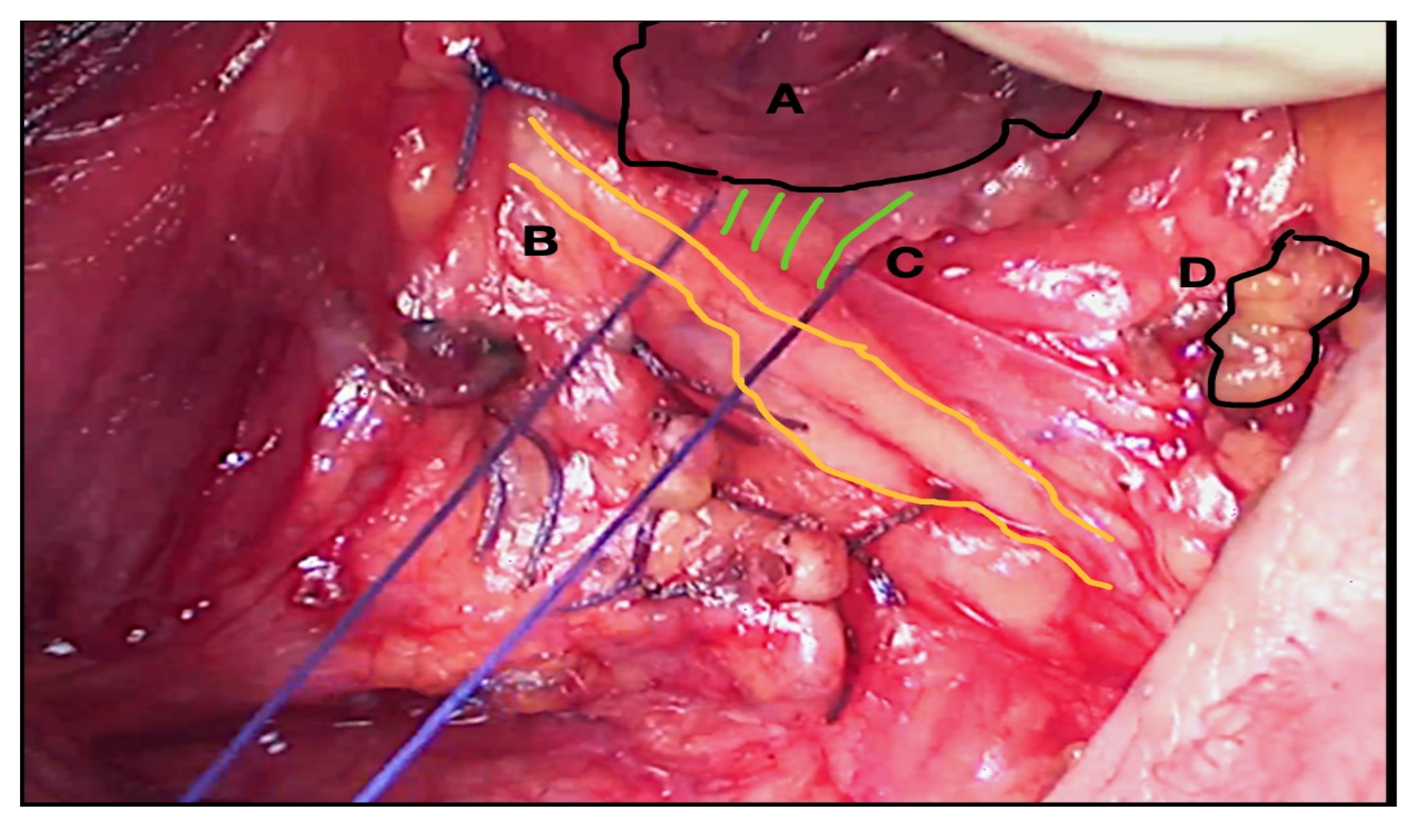 Medicina 58 01560 g004