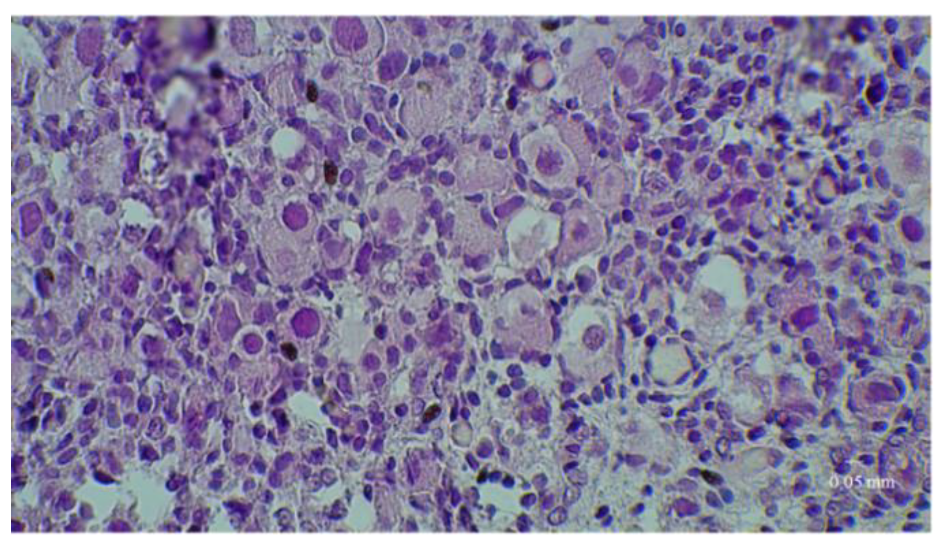 Medicina 58 01565 g002b