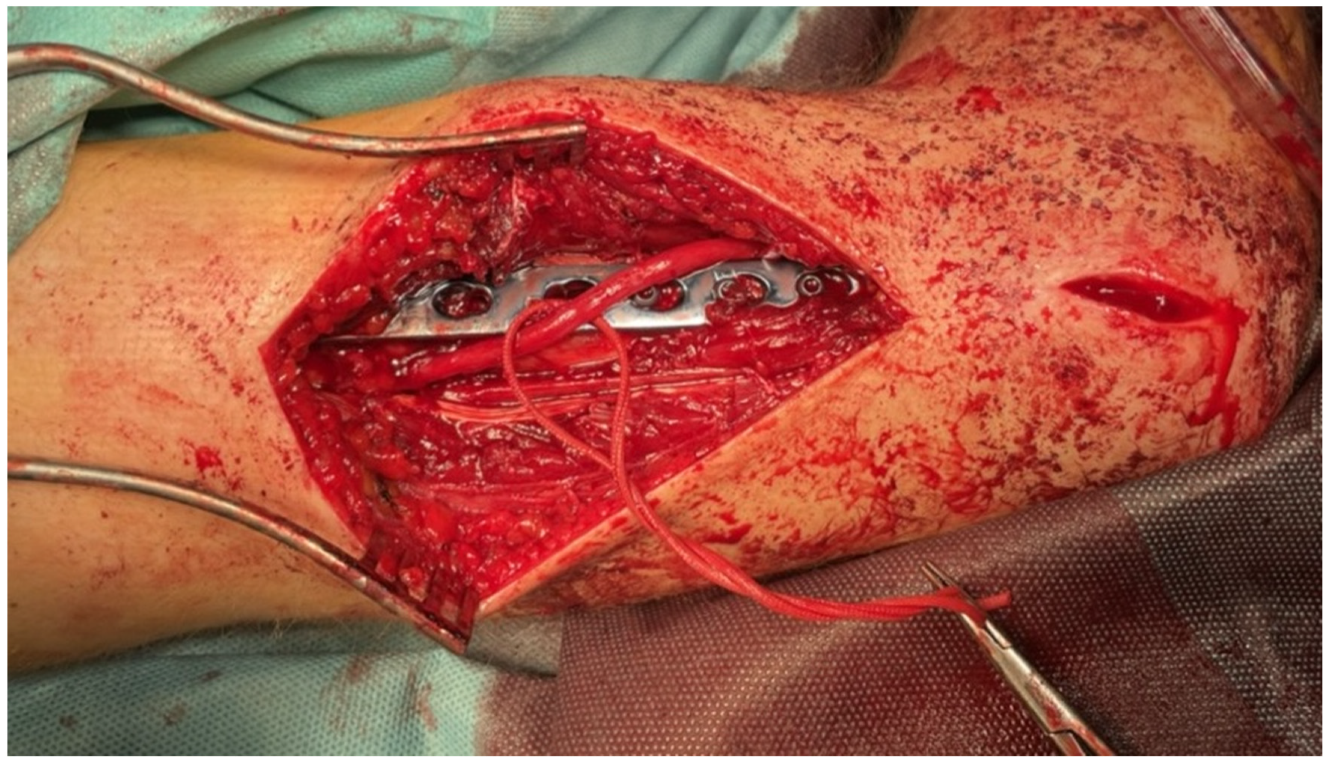 Medicina 58 01571 g002 Medicina 58 01571 g002