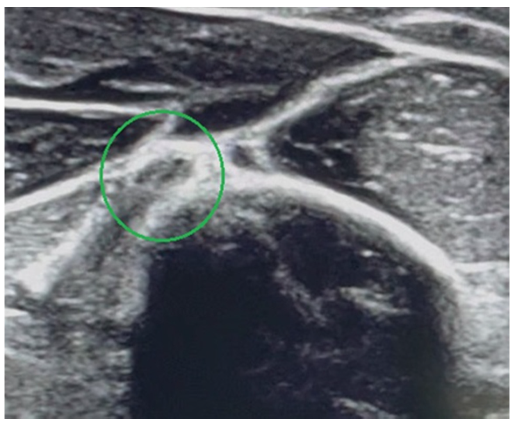 Medicina 58 01571 g003 Medicina 58 01571 g003