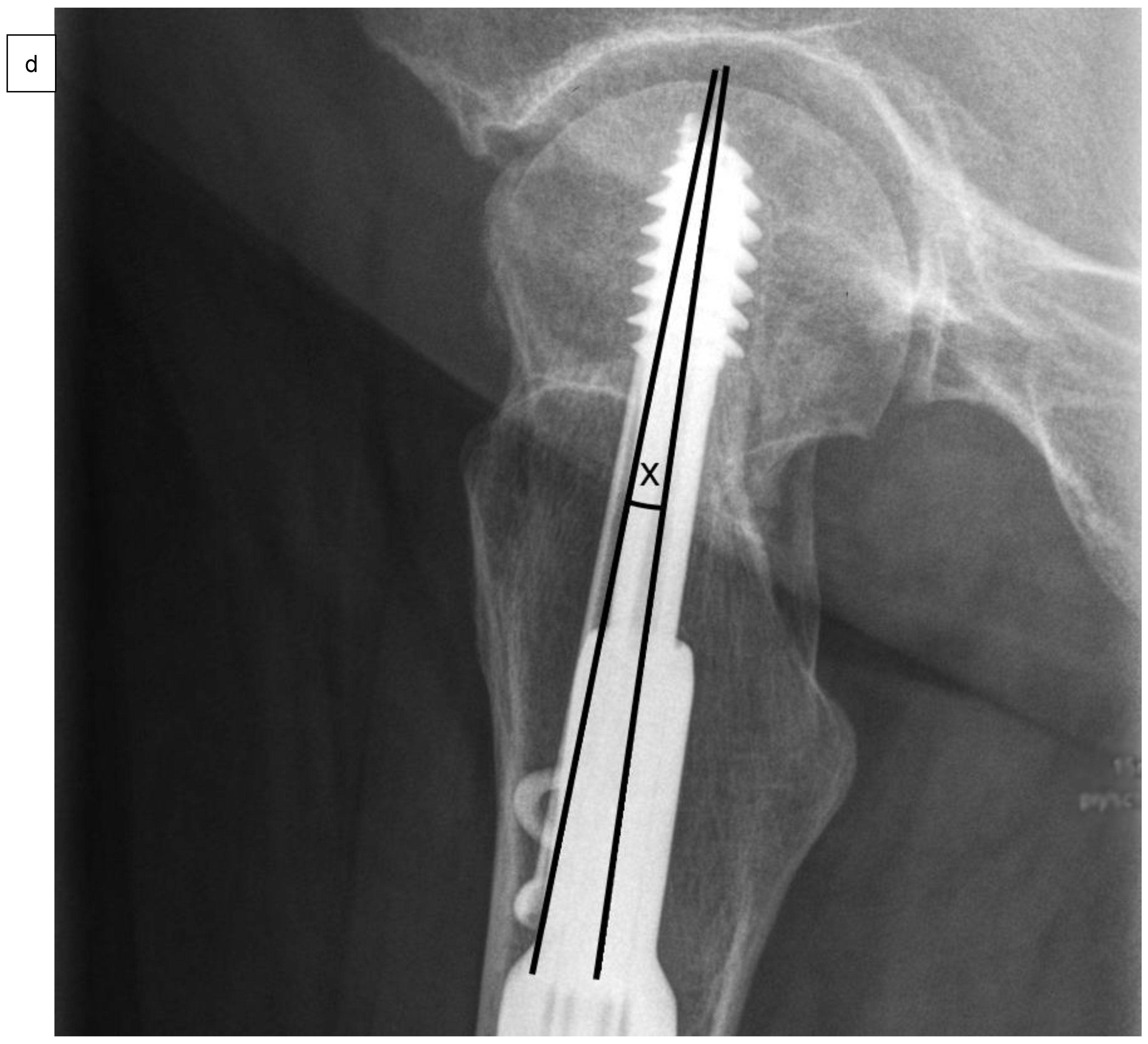 Medicina 58 01573 g002d Medicina 58 01573 g002d