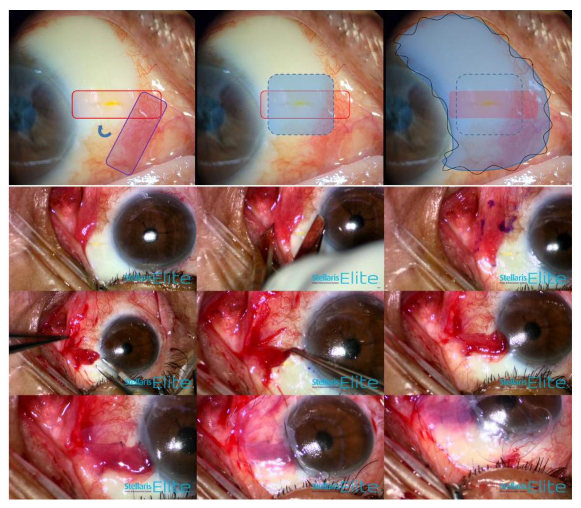 Medicina 58 01581 g004