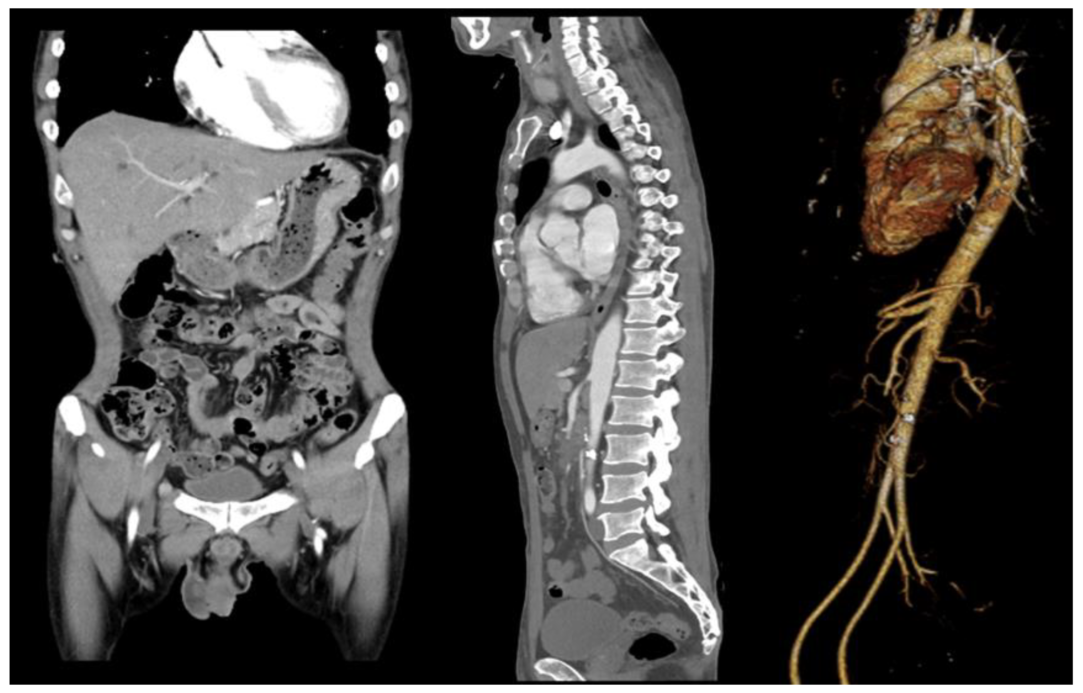 Medicina 58 01585 g001