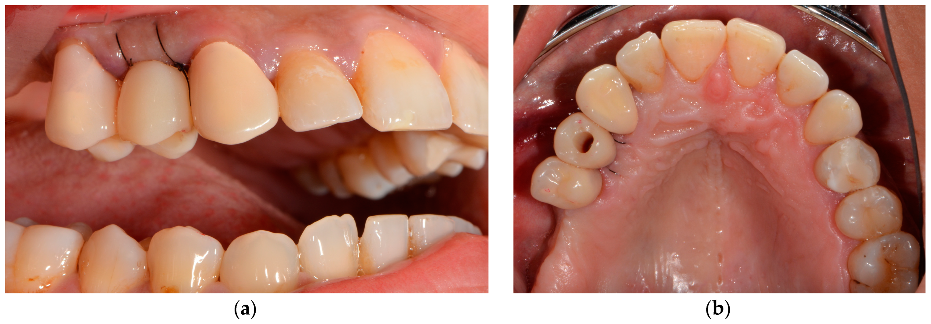 Medicina 58 01612 g013