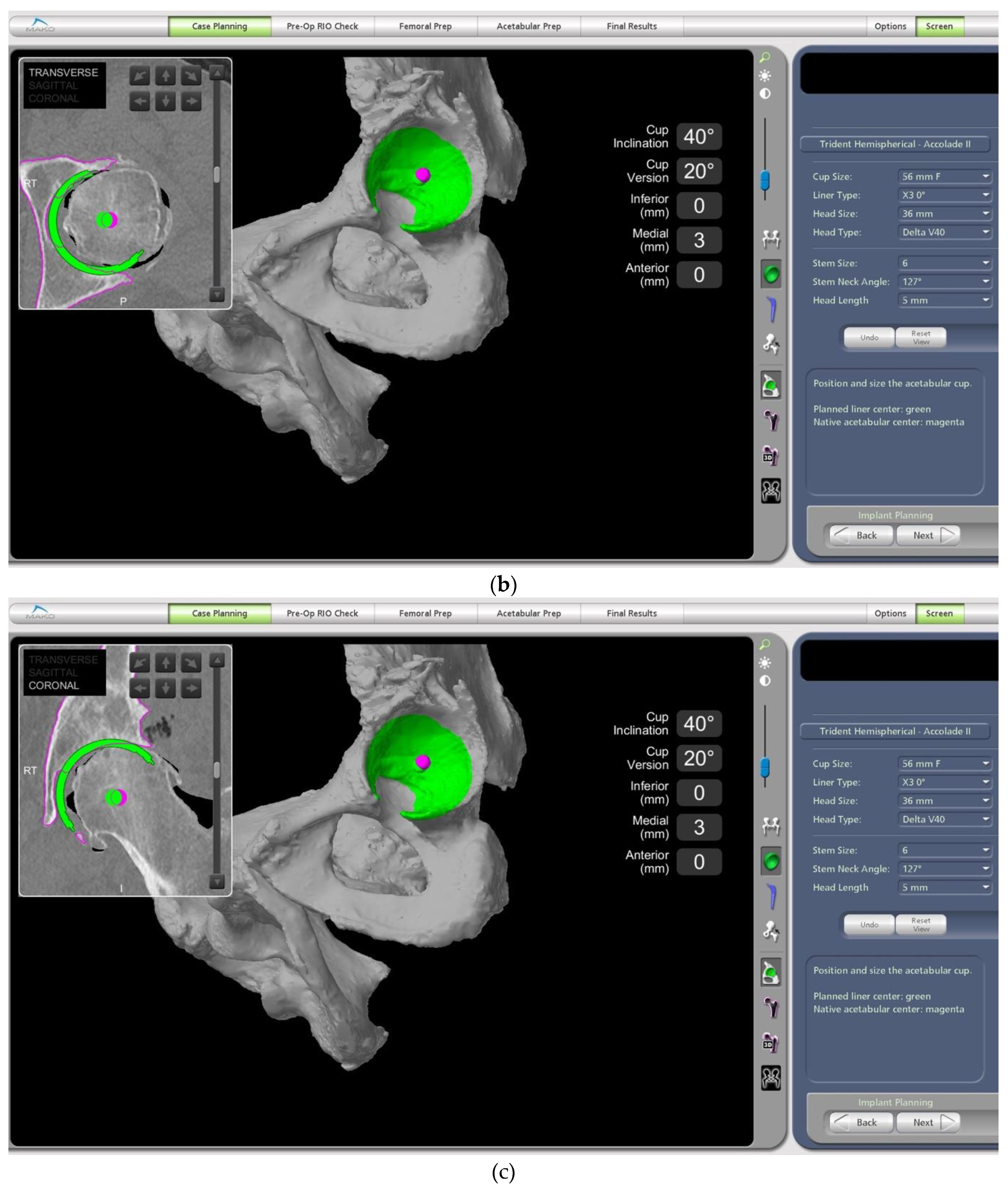 Medicina 58 01616 g003b