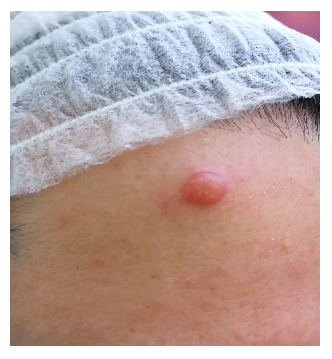 Medicina 58 01618 g001 Medicina 58 01618 g001