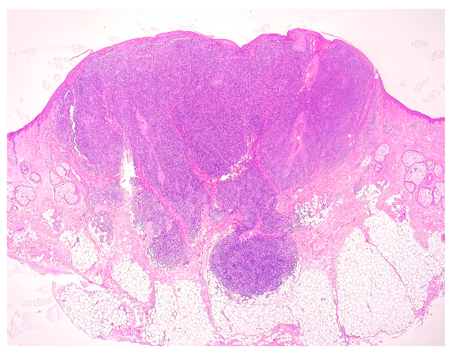 Medicina 58 01618 g002 Medicina 58 01618 g002