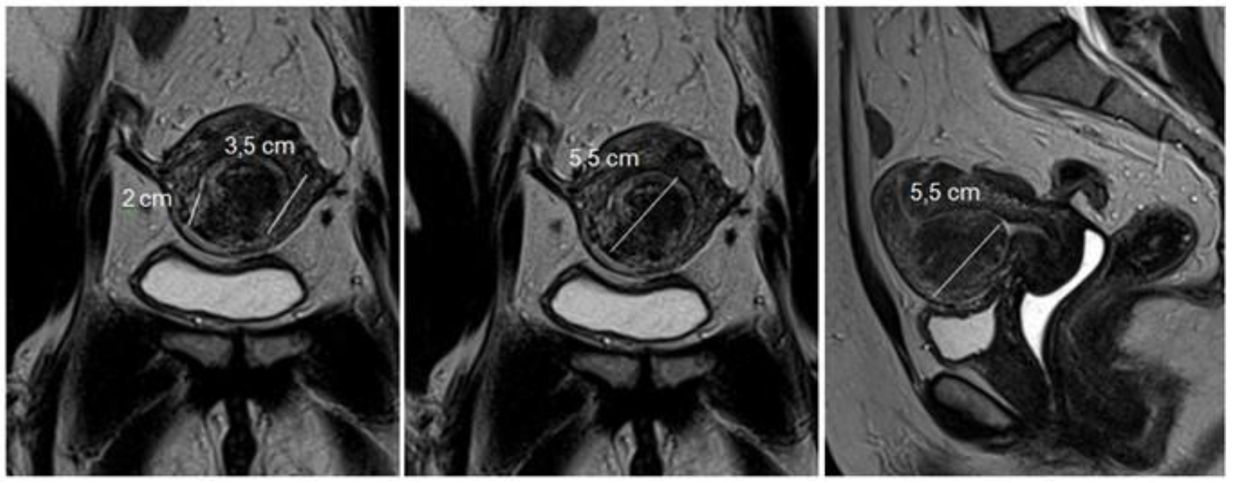 Medicina 58 01627 g005