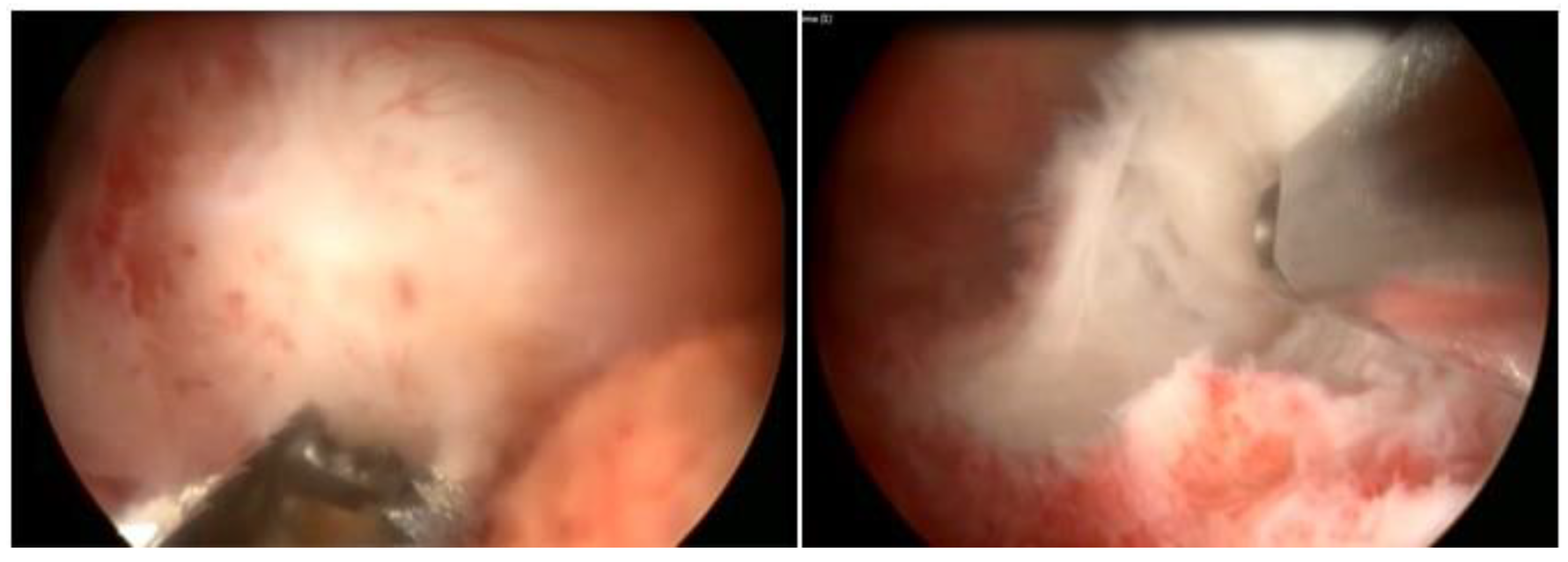 Medicina 58 01627 g011