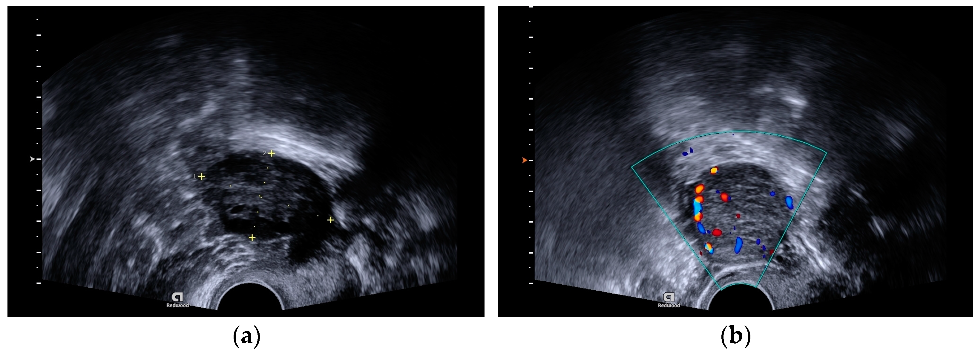 Medicina 58 01638 g001
