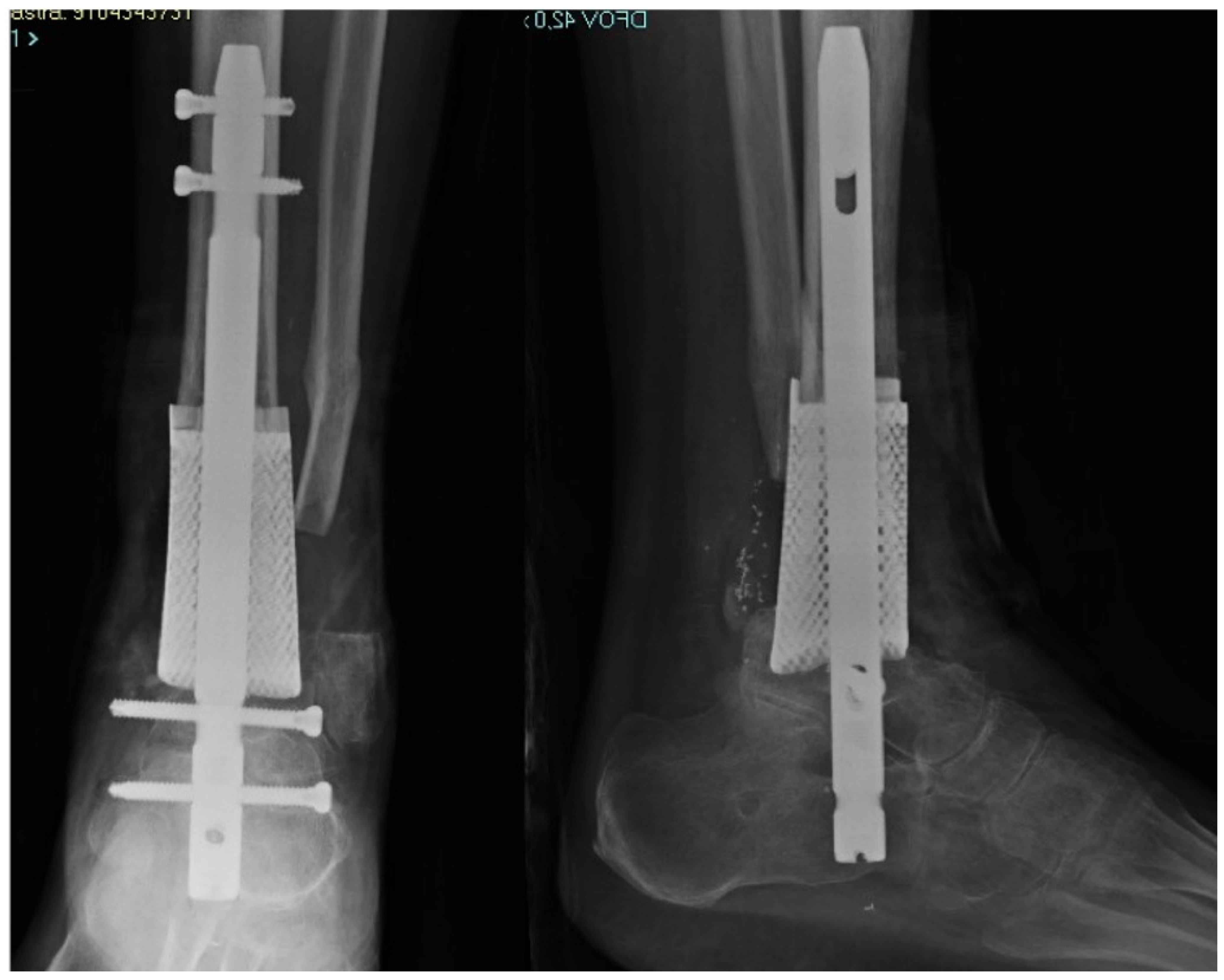 Medicina 58 01641 g004