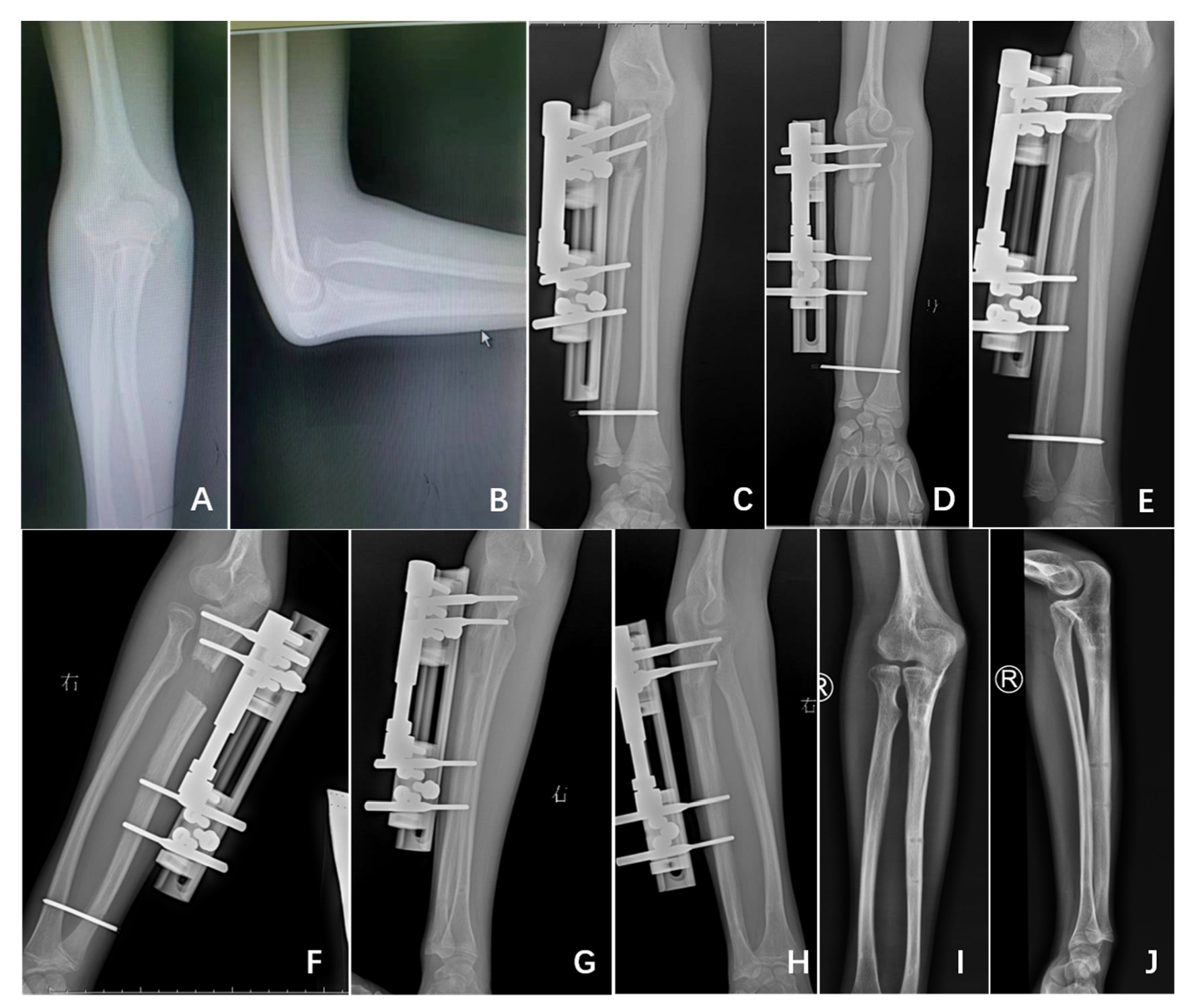 Medicina 58 01666 g002 Medicina 58 01666 g002