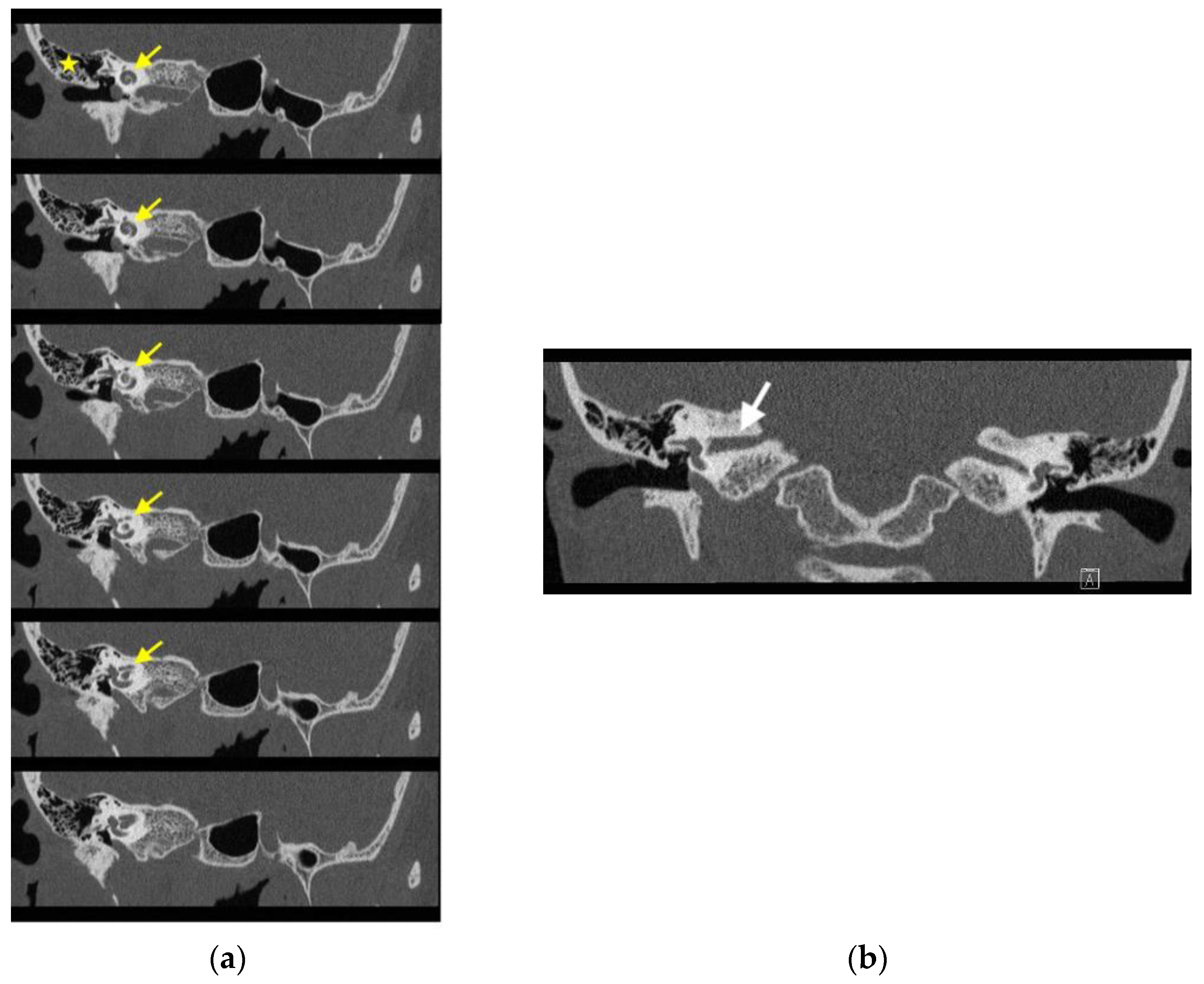 Medicina 58 01672 g004