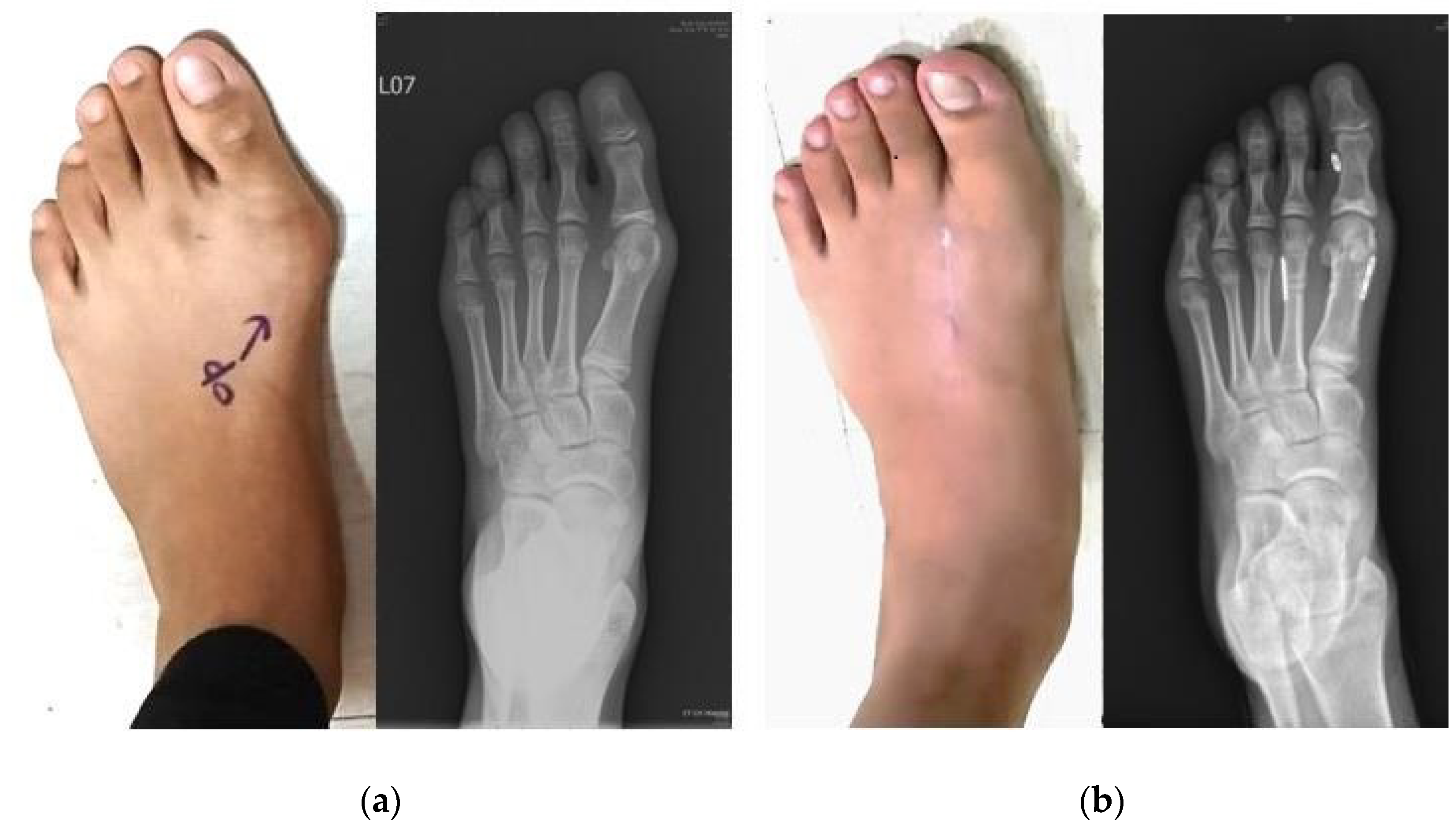 Medicina 58 01679 g004