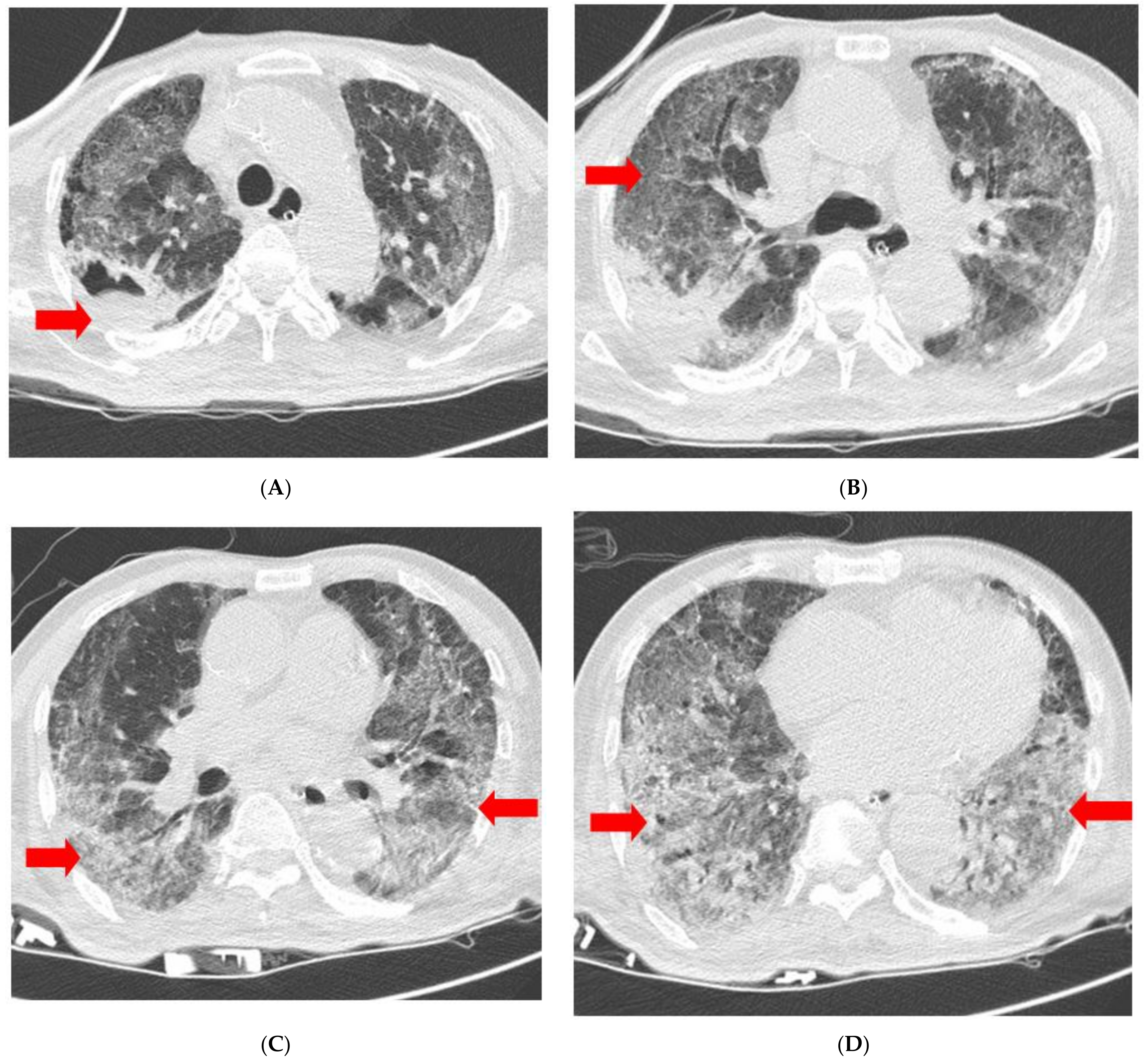 Medicina 58 01698 g002