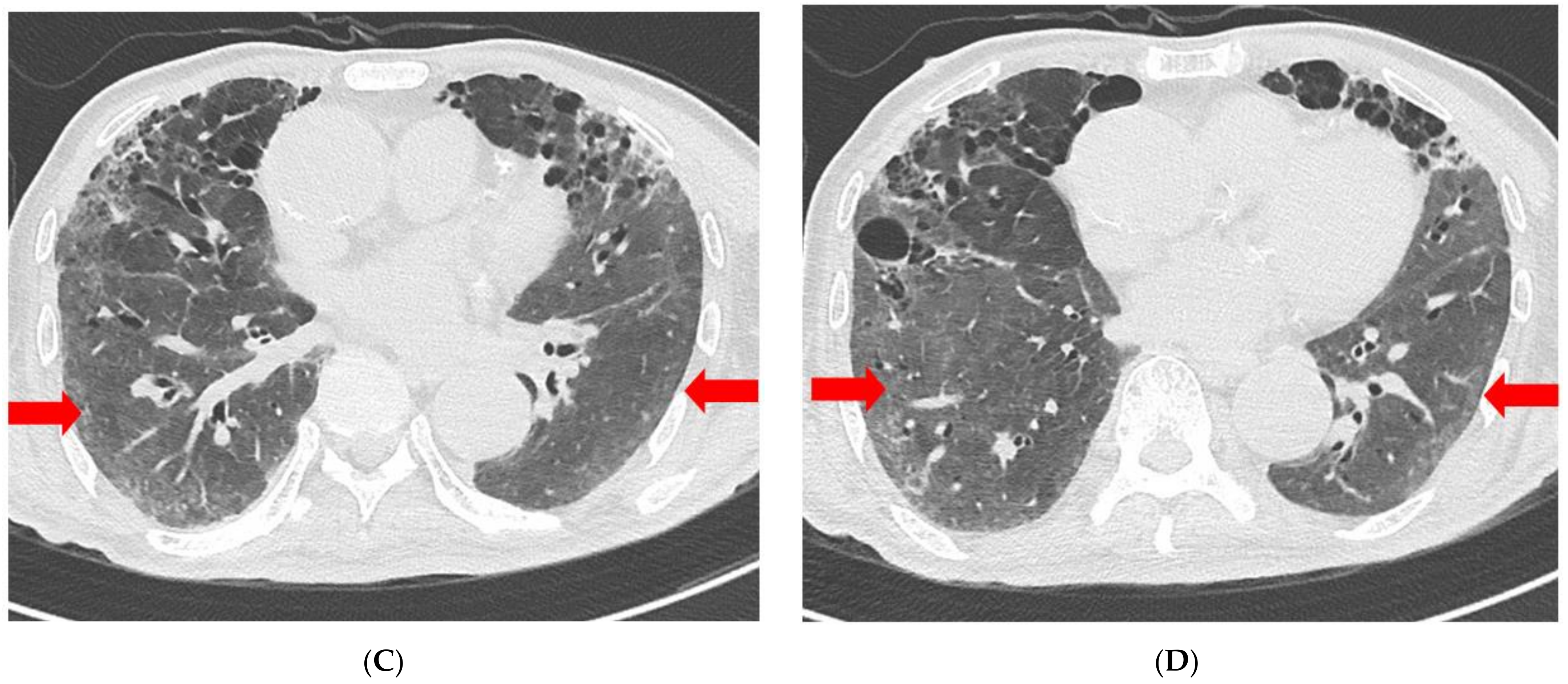 Medicina 58 01698 g004b
