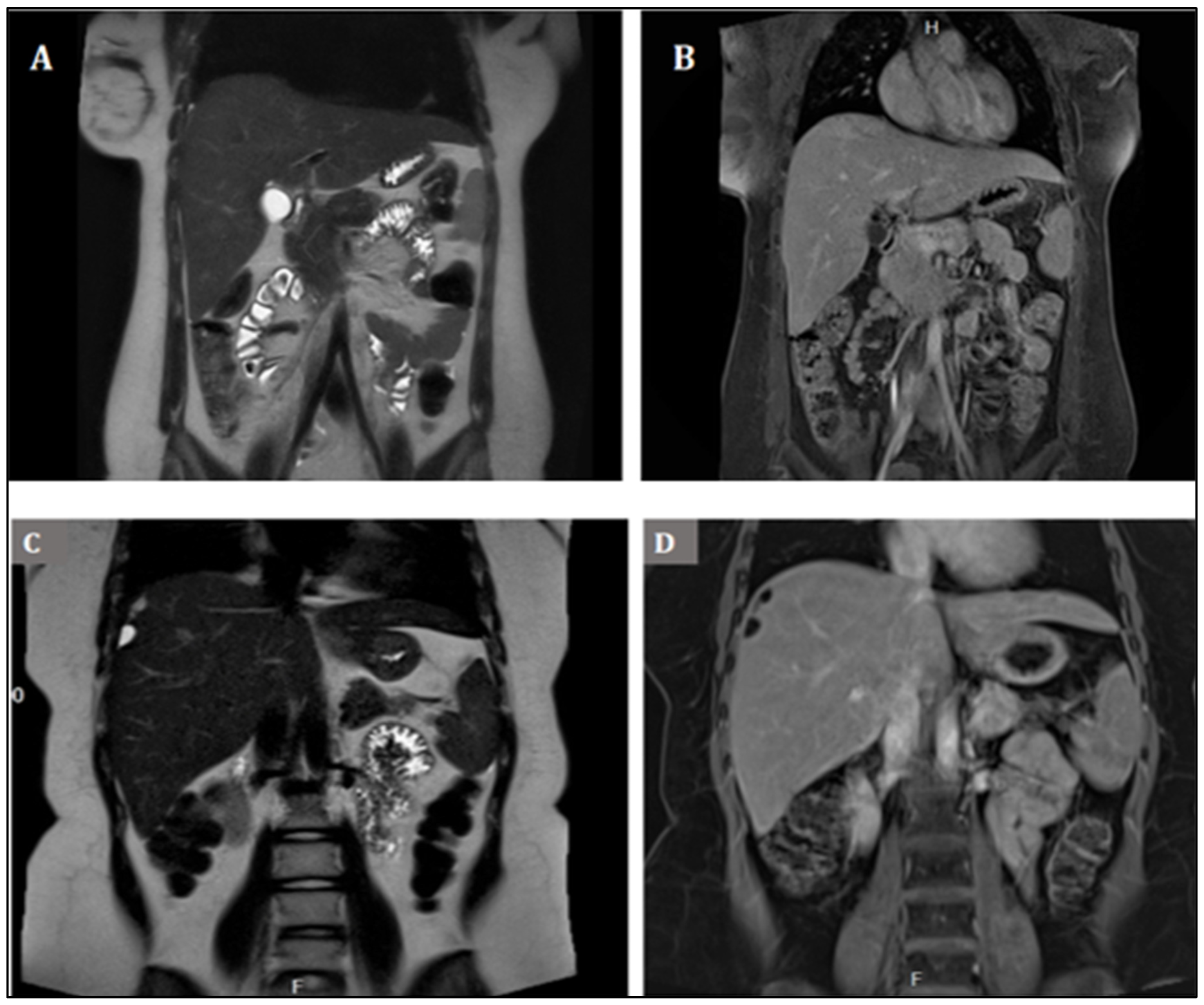 Medicina 58 01715 g003