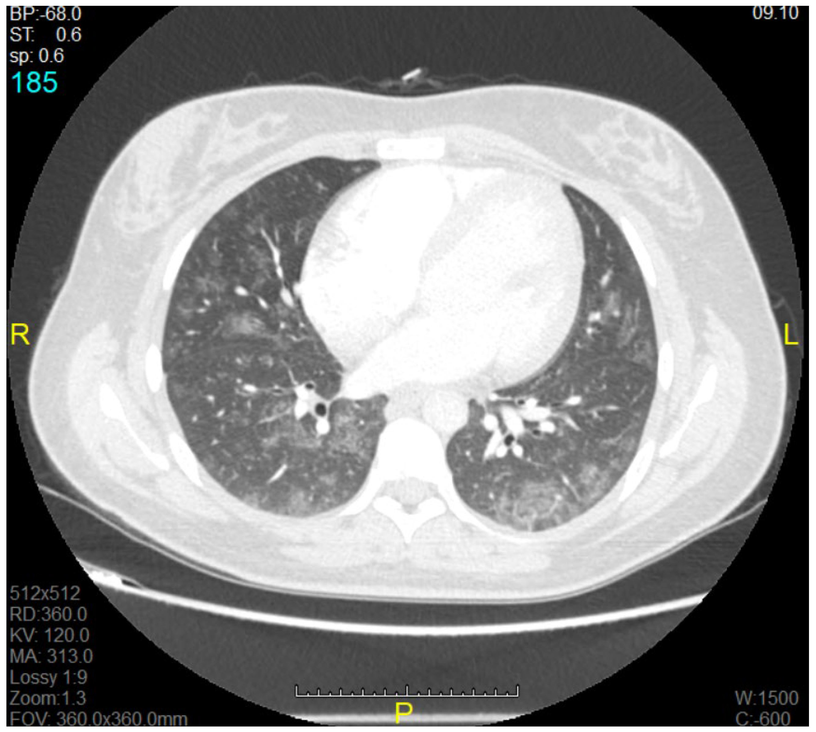 Medicina 58 01730 g001