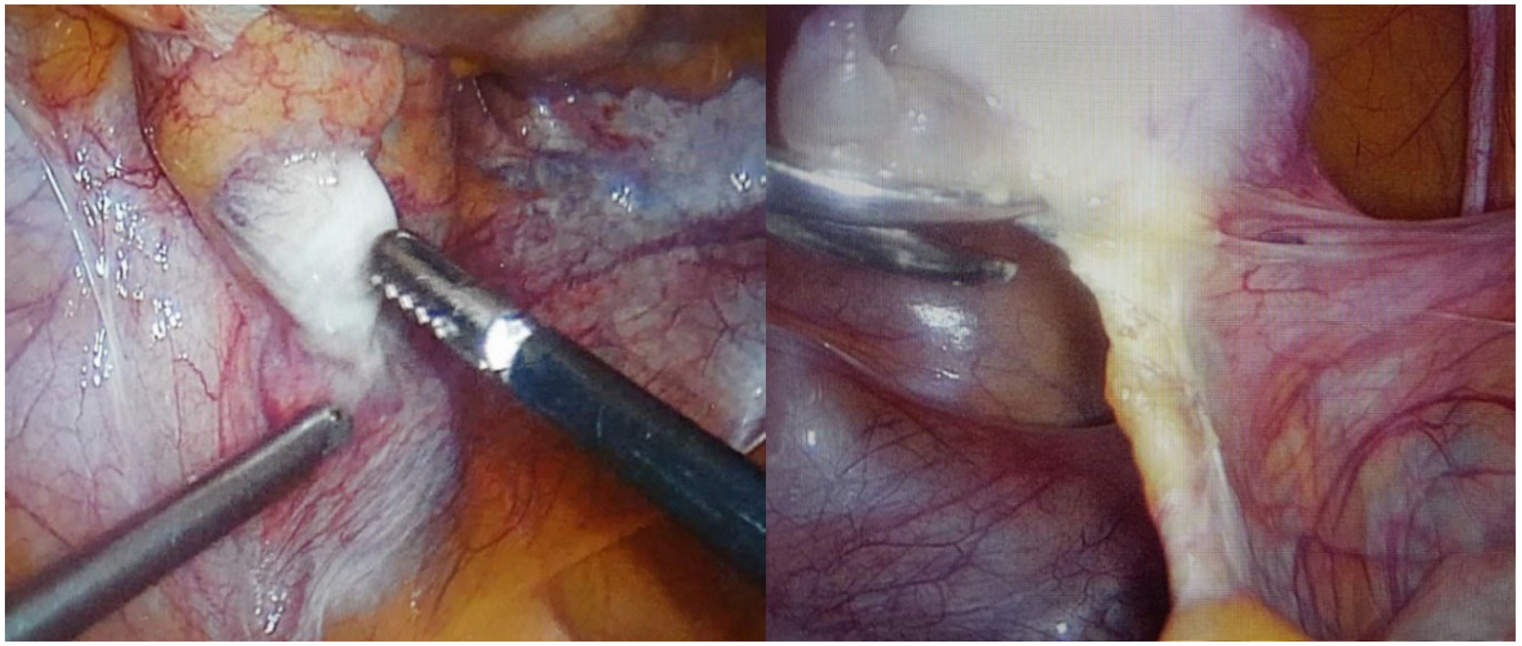 Medicina 58 01736 g002