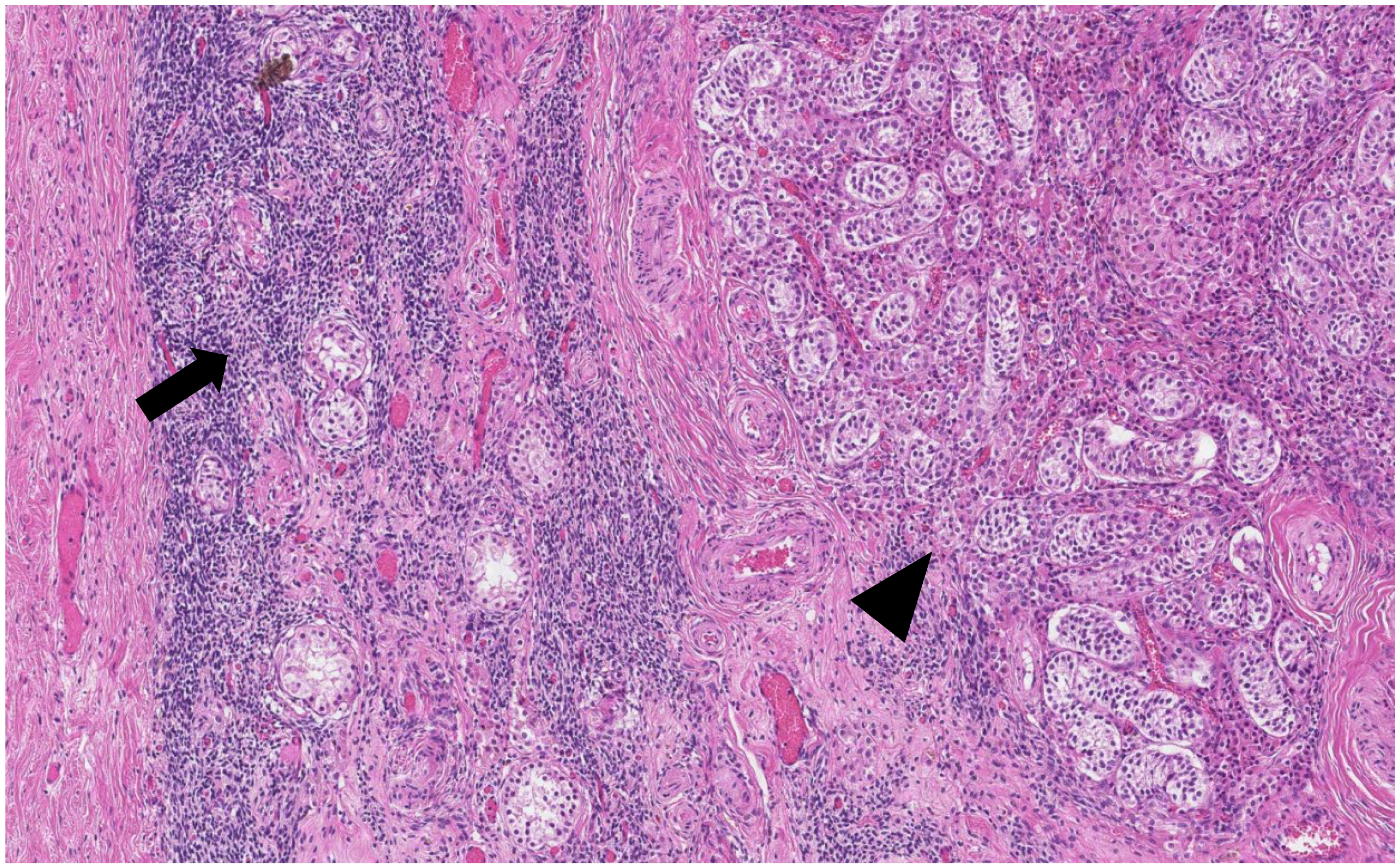 Medicina 58 01736 g004