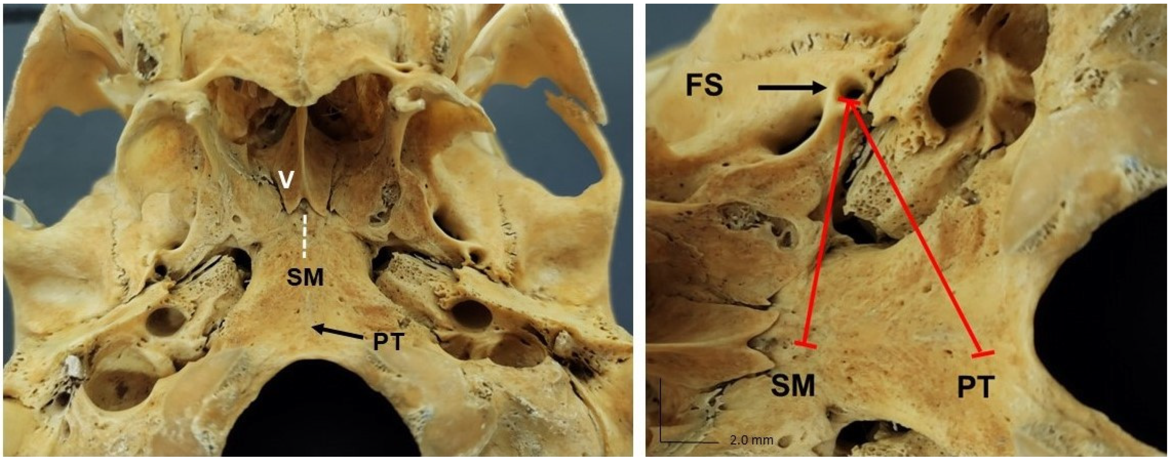 Medicina 58 01740 g003