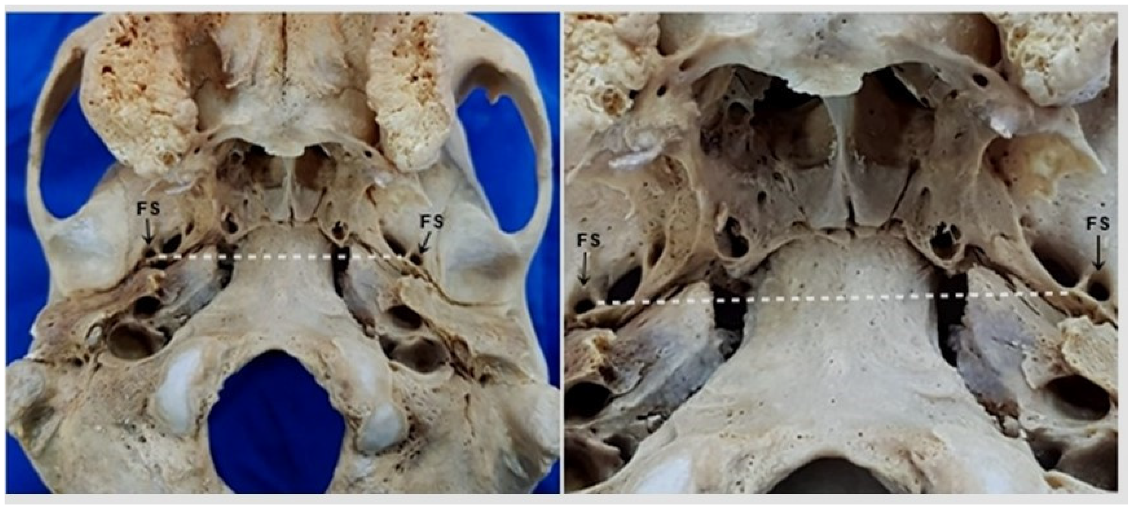 Medicina 58 01740 g004