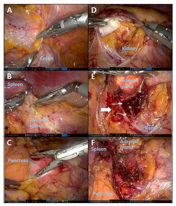 Medicina 58 01747 g003