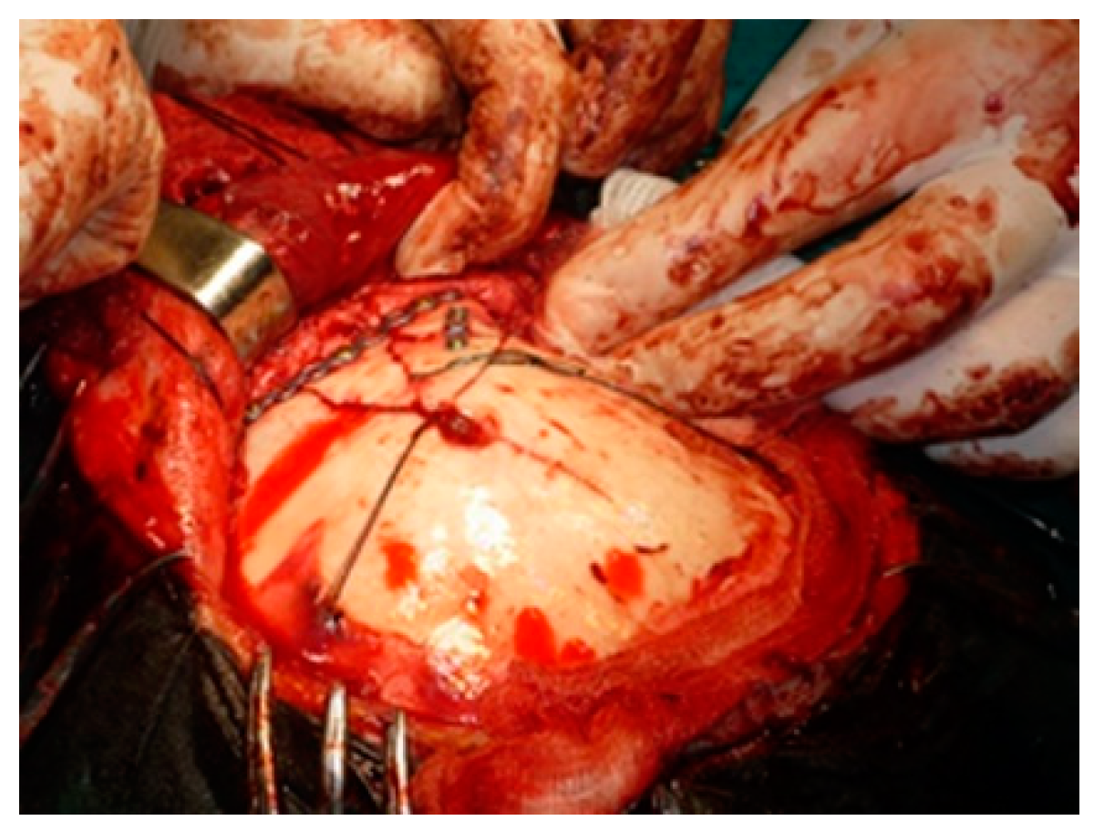 Medicina 58 01756 g004