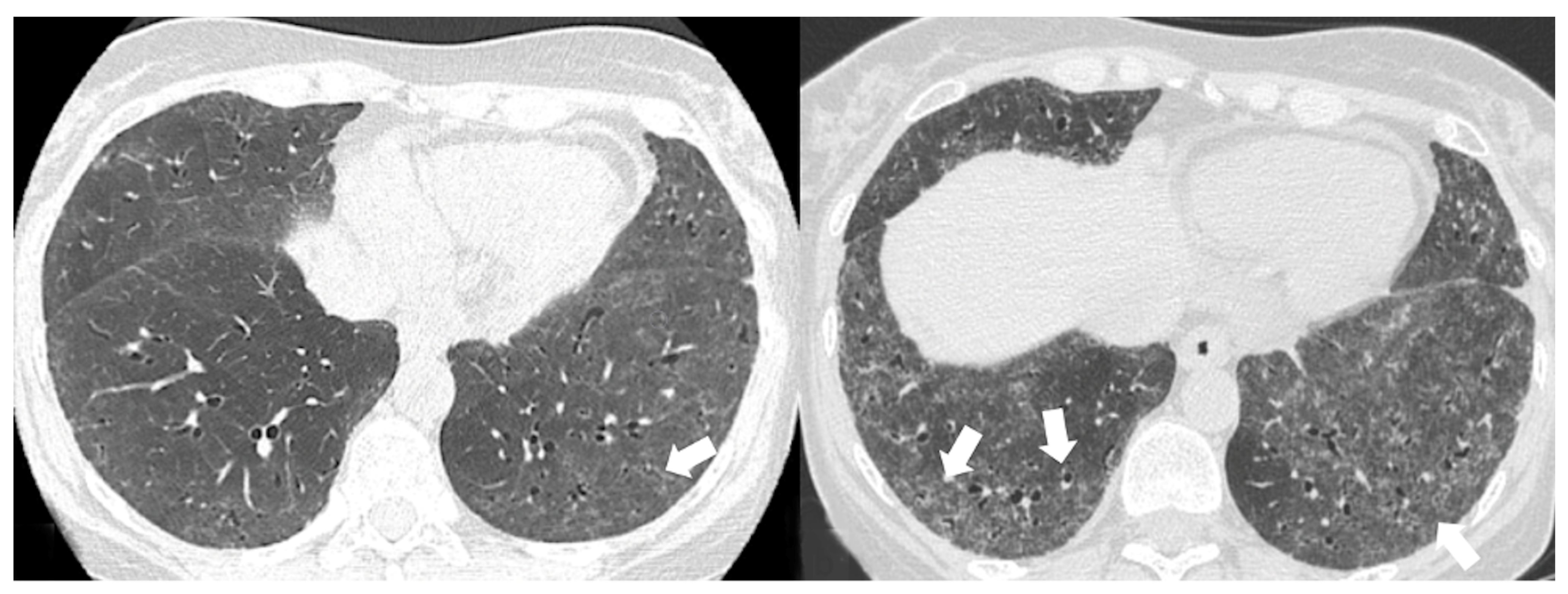 Medicina 58 01757 g005