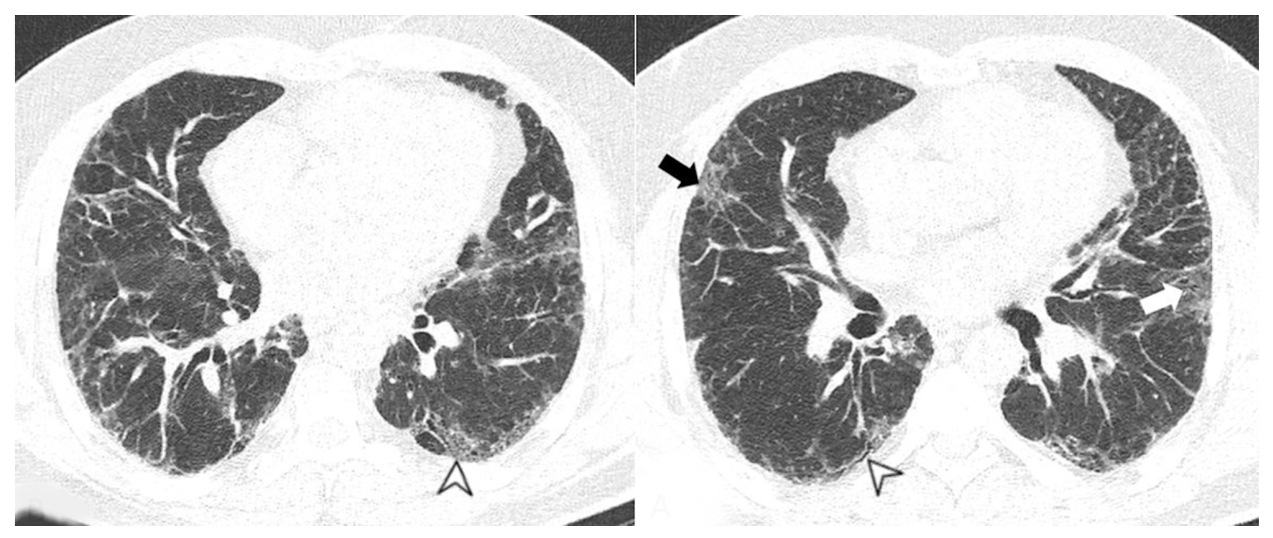 Medicina 58 01757 g006