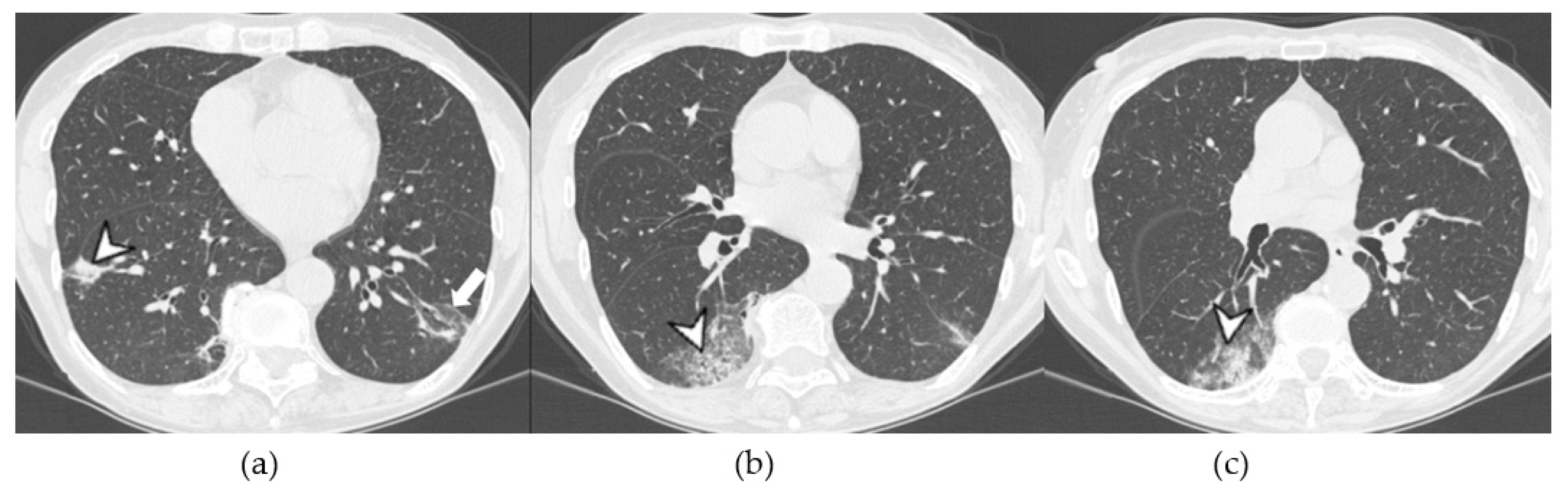 Medicina 58 01757 g009