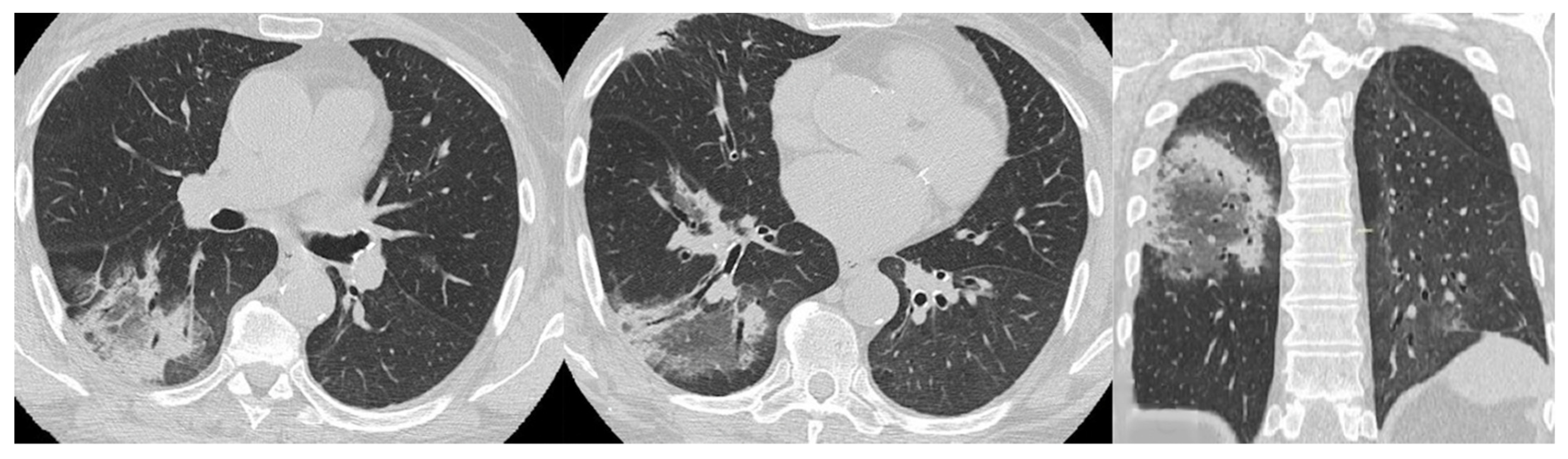 Medicina 58 01757 g010
