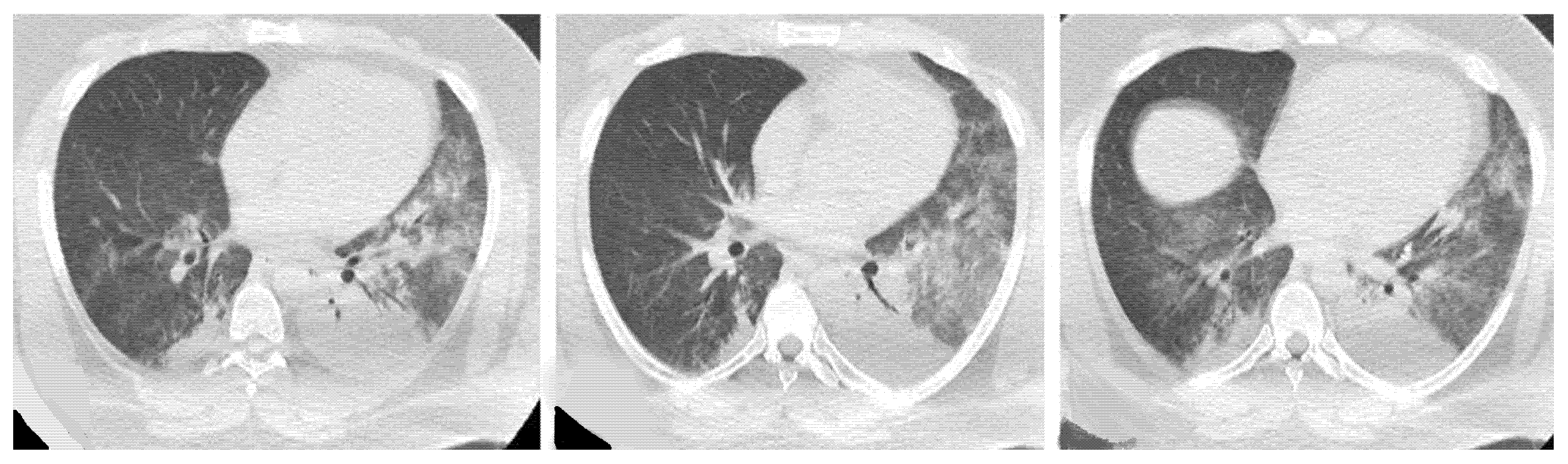 Medicina 58 01757 g013