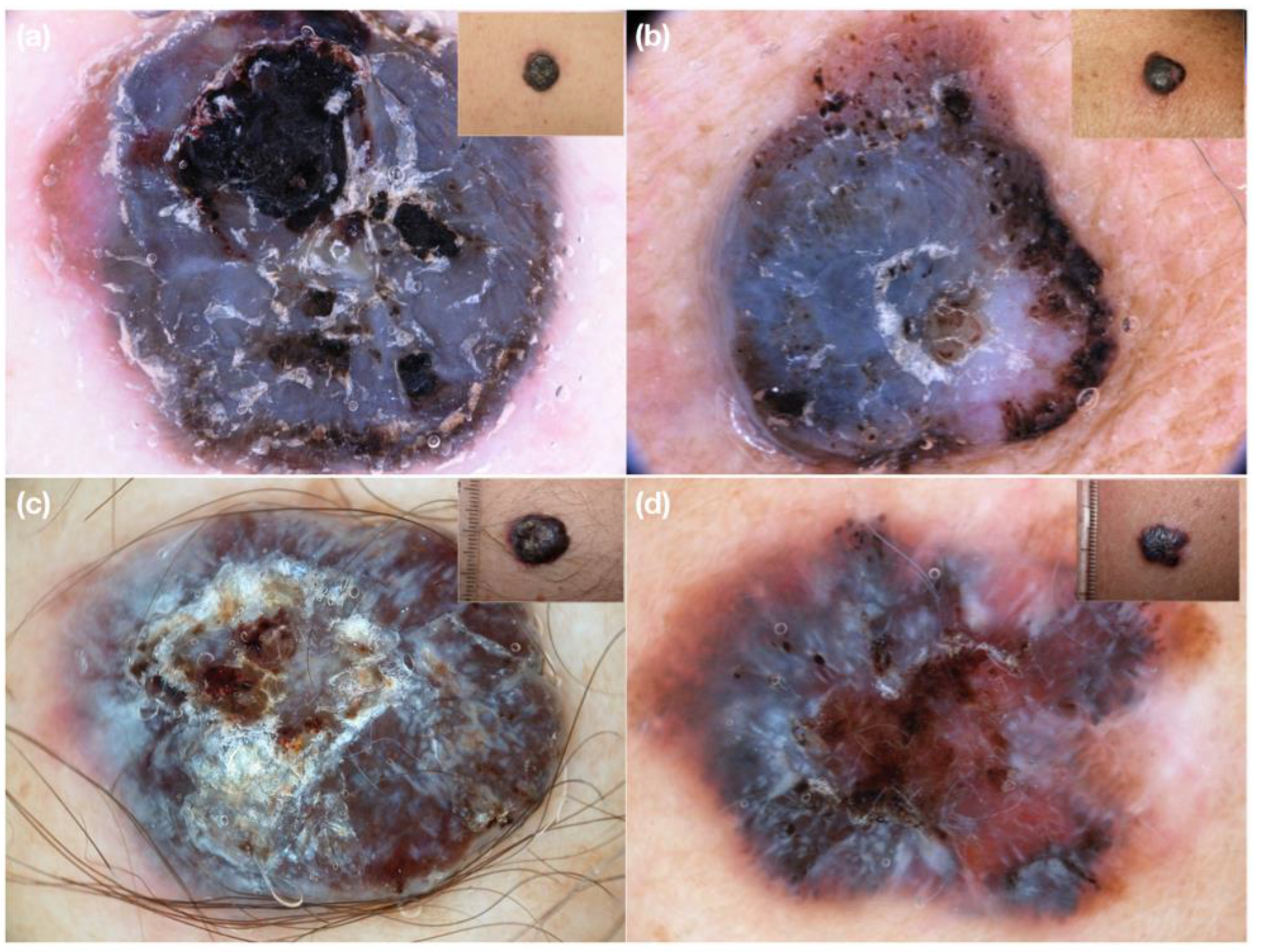 Medicina 58 01761 g004 Medicina 58 01761 g004