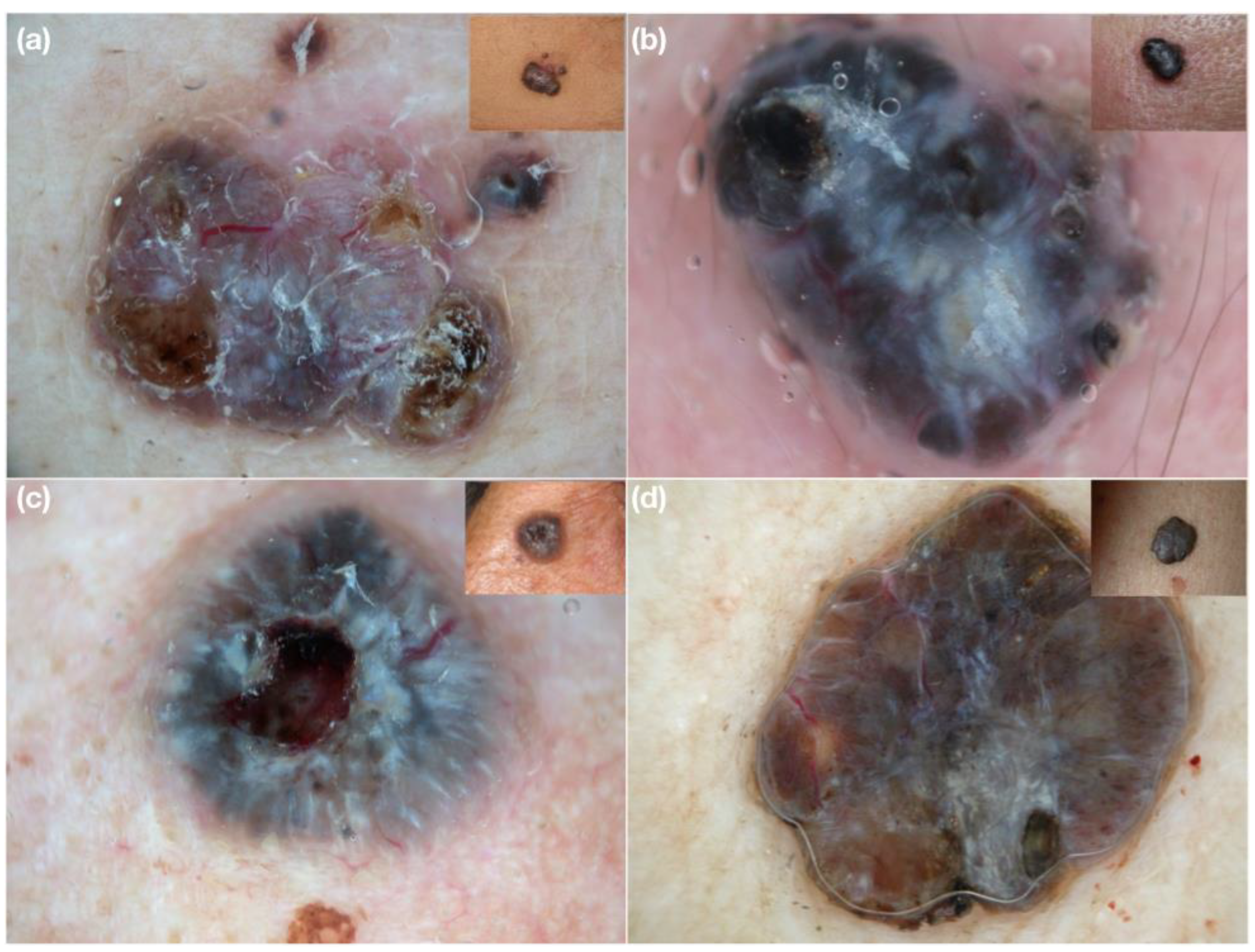 Medicina 58 01761 g005 Medicina 58 01761 g005