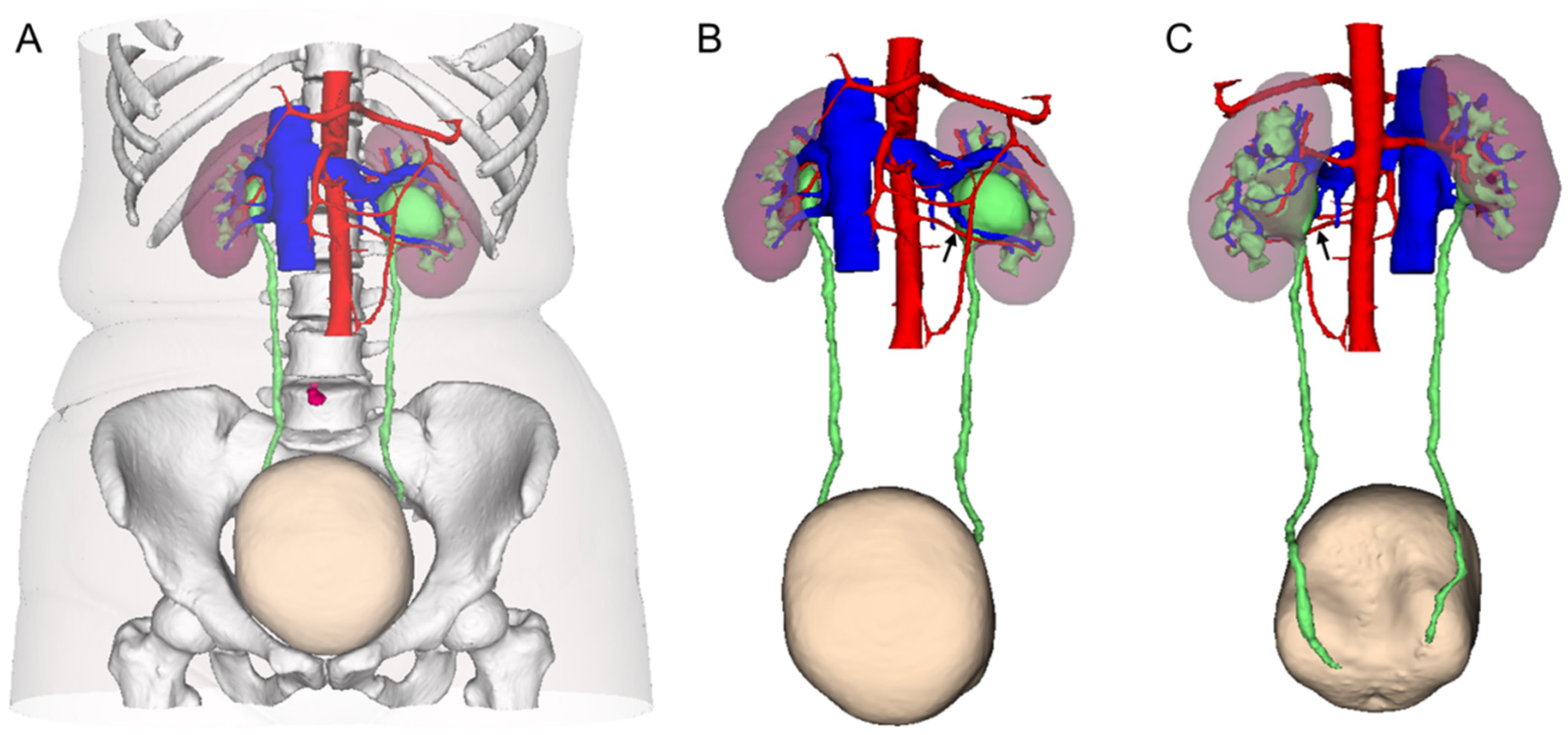 Clinical Application of the Computed-Tomography-Based Three Clinical Application of the Computed-Tomography-Based Three