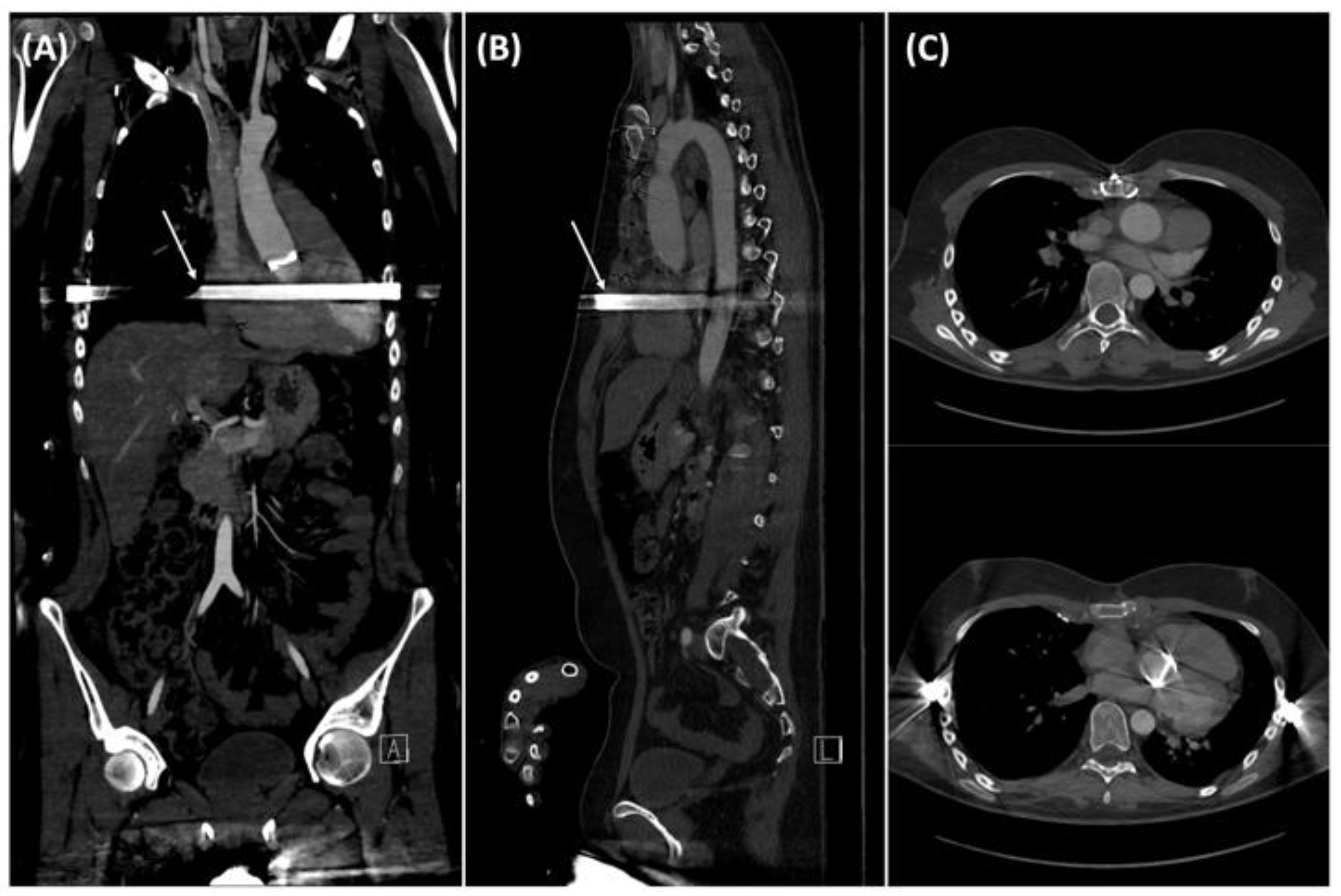 Medicina 58 01774 g004